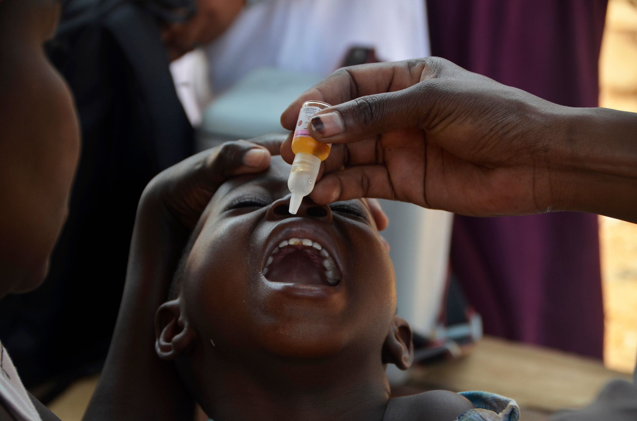 Nach Polio-Fall: Impf-Kampagne für 2,9 Millionen Kinder