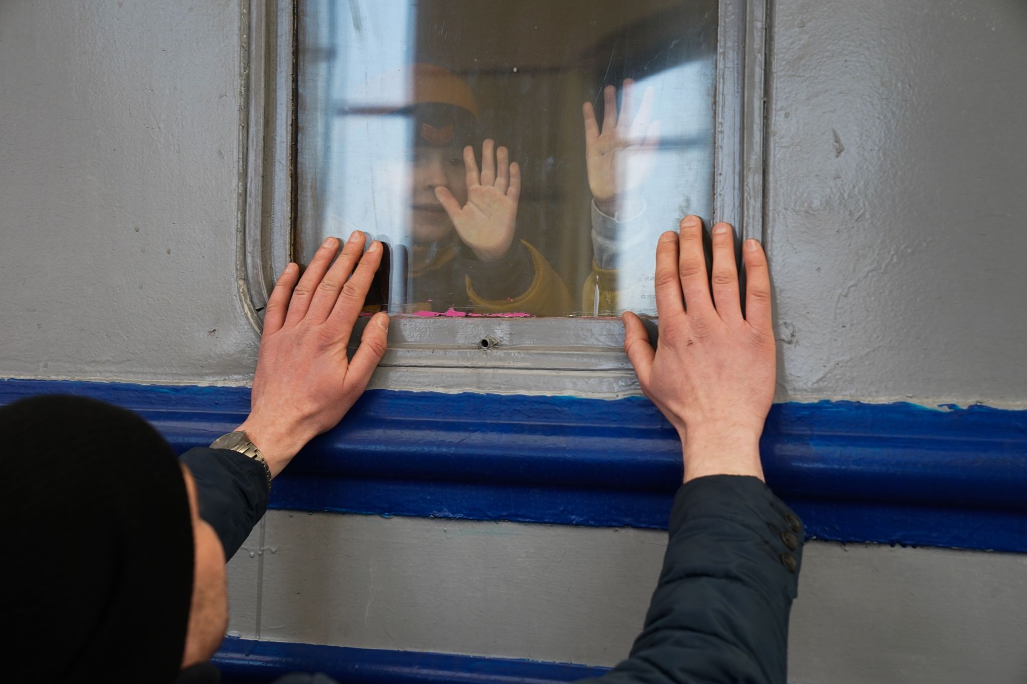 Krankenhaus in Lwiw überlastet durch kriegsverletzte Kinder