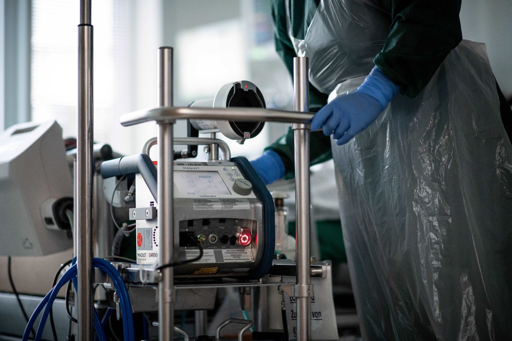 Ecmo-Therapie: Experten alarmiert wegen Pandemie-Sterberaten