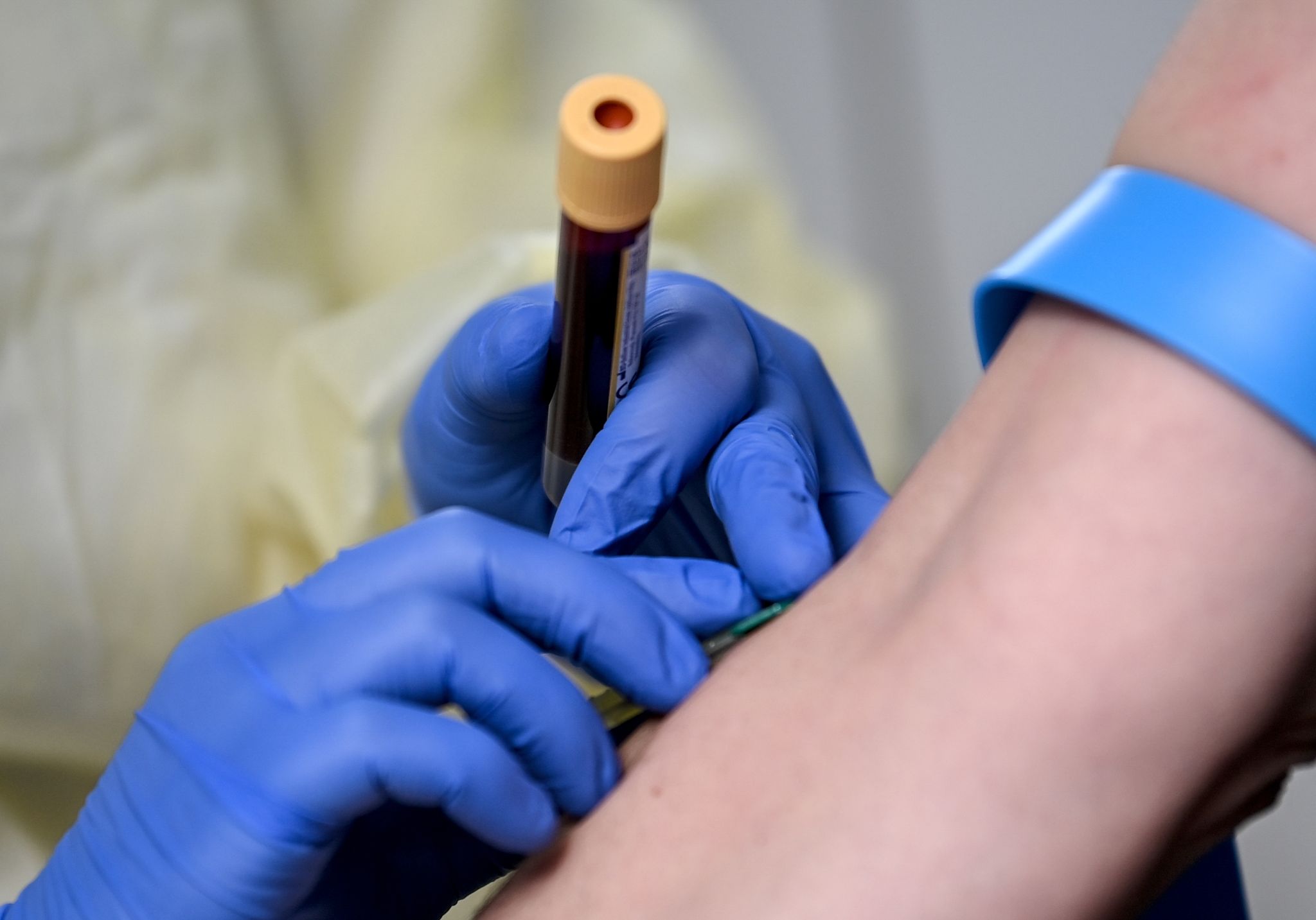 Menschen in Europa teils hoch mit Schadstoffen belastet