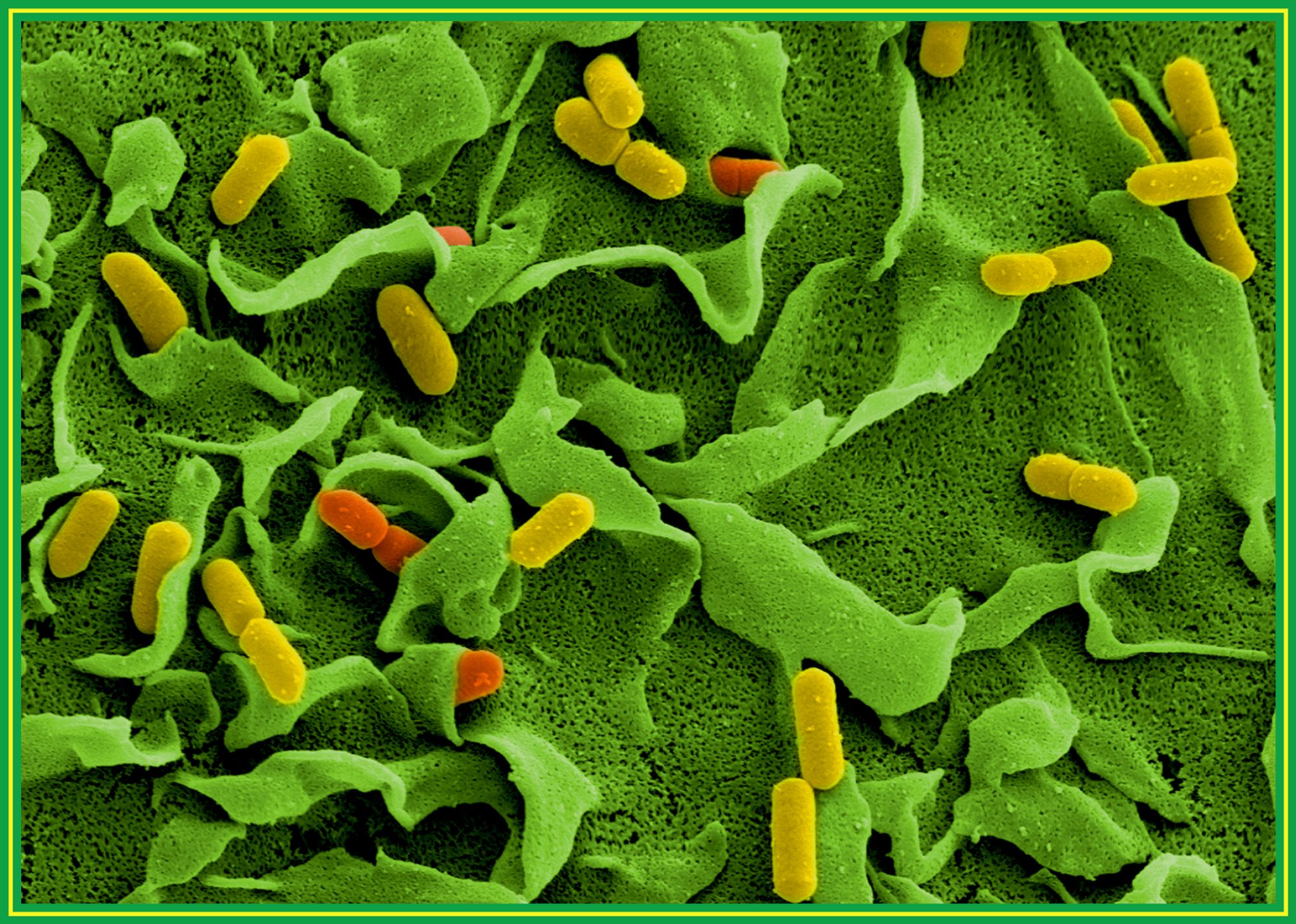 Toter durch Hygienemängel in Betrieb – «höchst belastend»