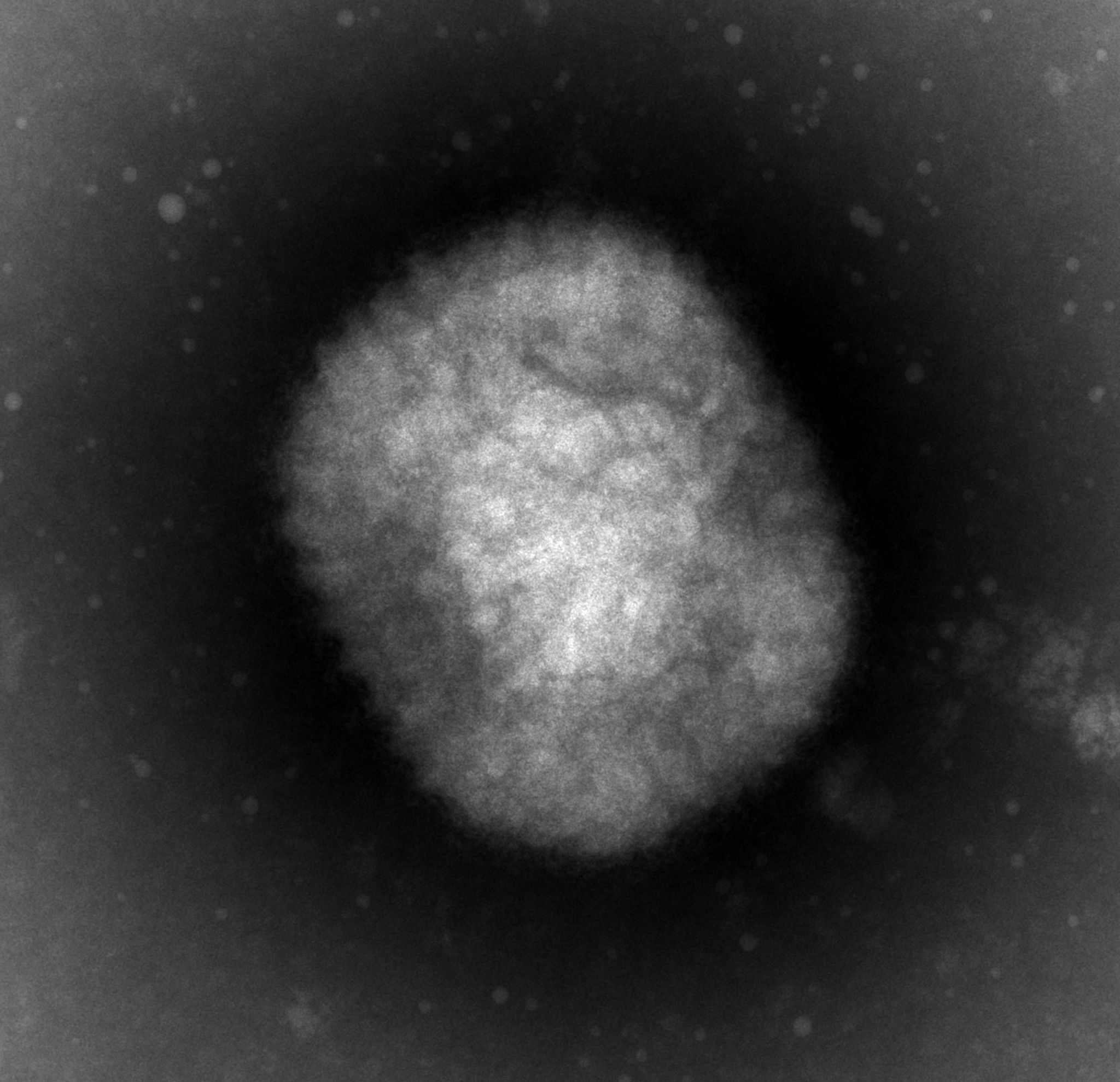 Affenpocken – Zweiter Ansteckungsherd auf Kanaren?