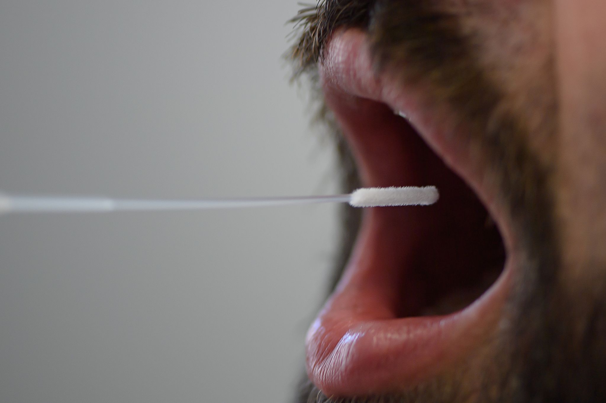 Sieben-Tage-Inzidenz bei 307,2 – 64.437 Neuinfektionen