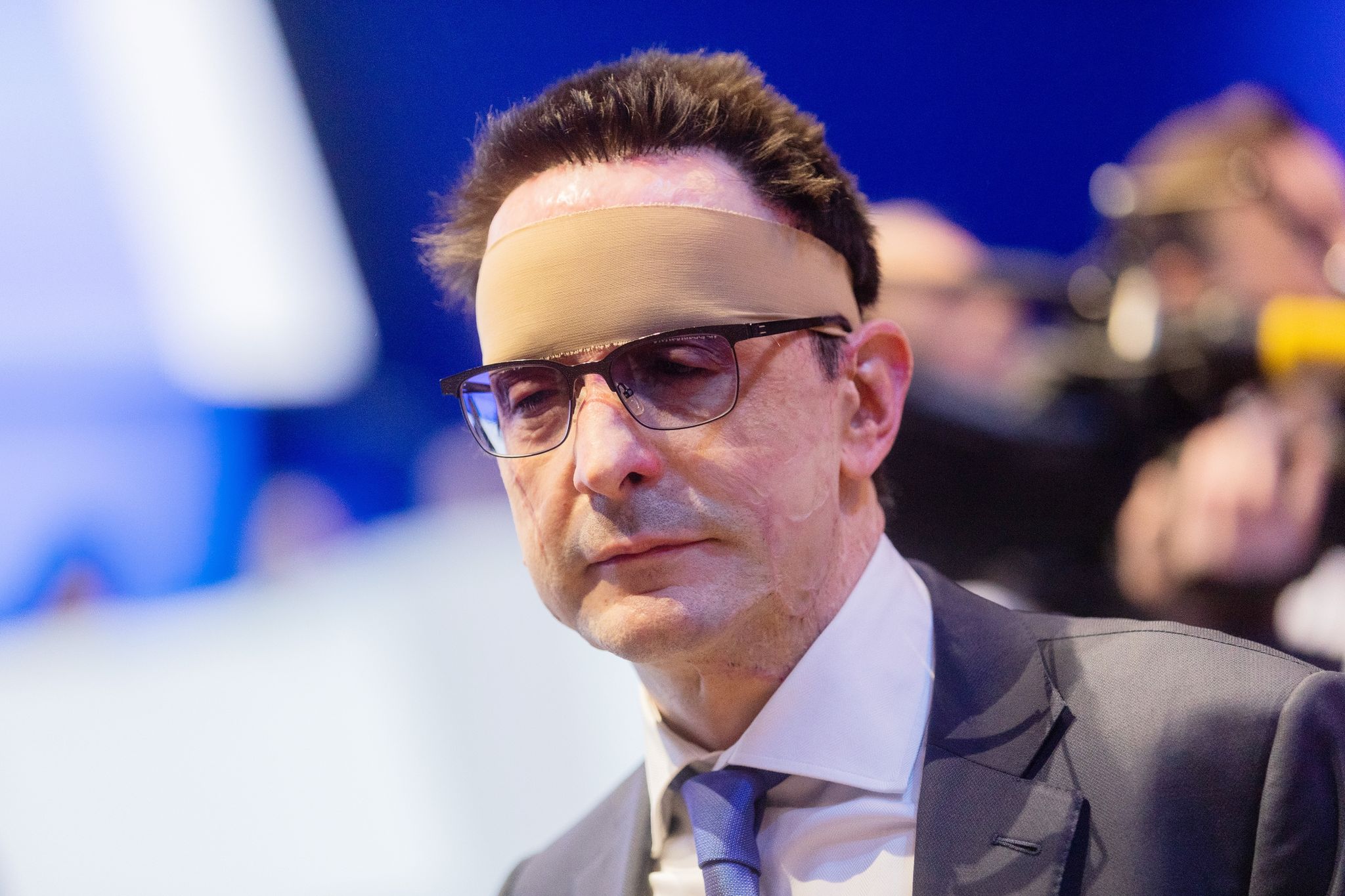 Prozess um Säureanschlag auf Manager beginnt Ende Juni