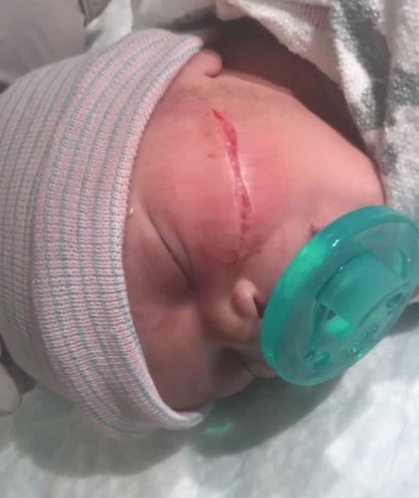 Ärzte zerschneiden Babygesicht