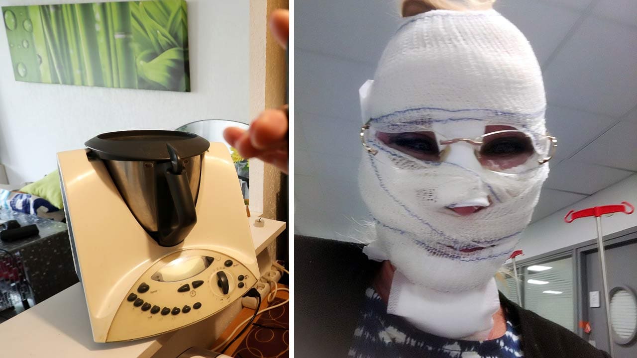Allein das Foto tut weh! – Thermomix explodiert – Hausfrau verbrannt