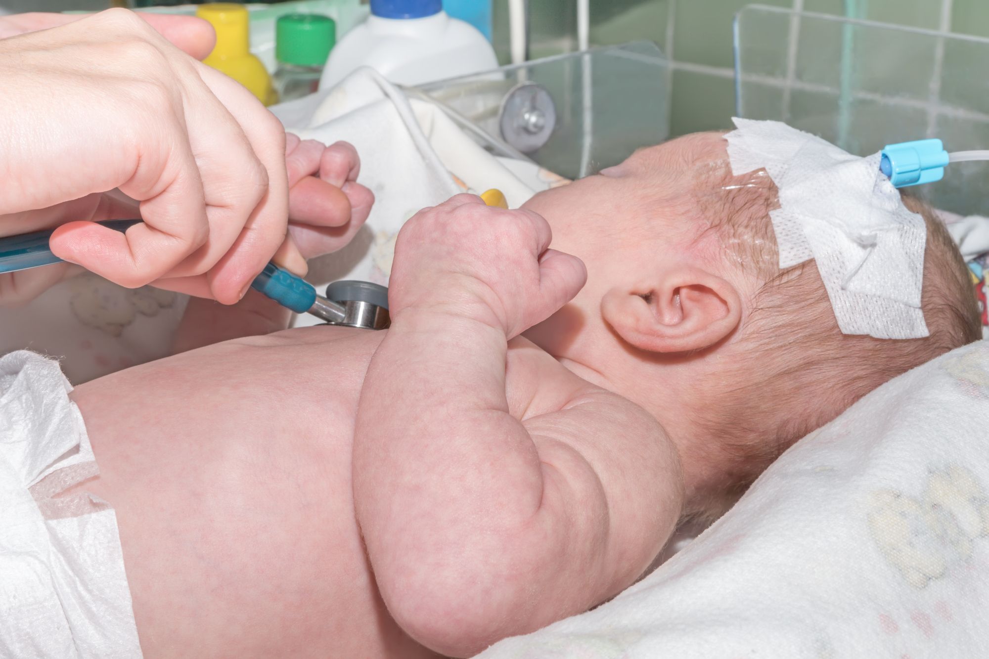 Baby mit zwei Köpfen und drei Händen geboren