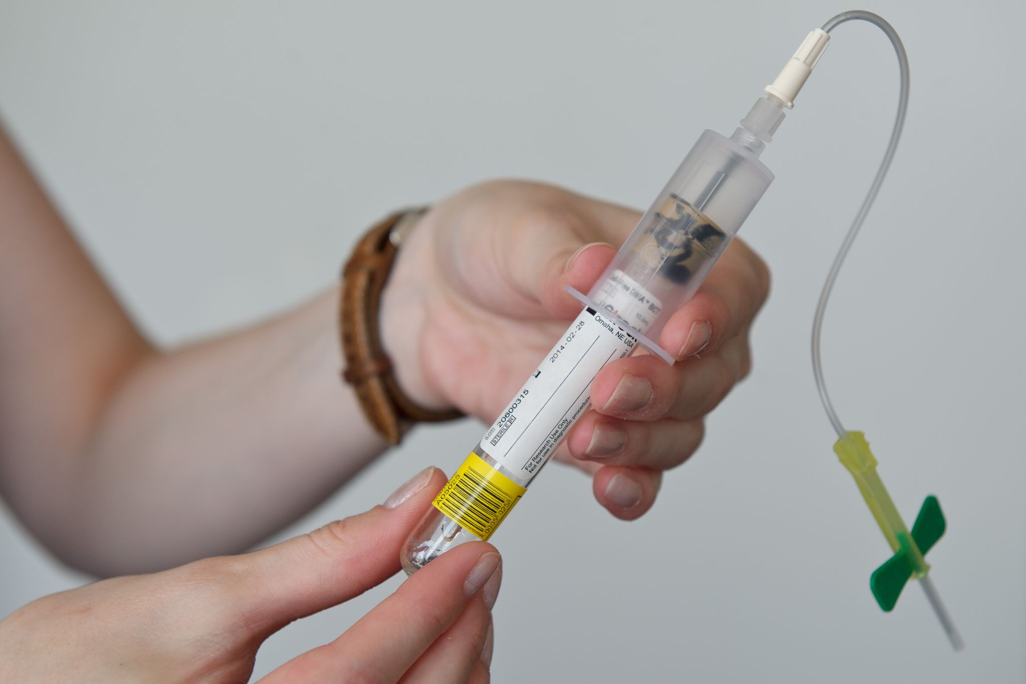 Kasse zahlt nun Trisomie-Test bei Schwangeren