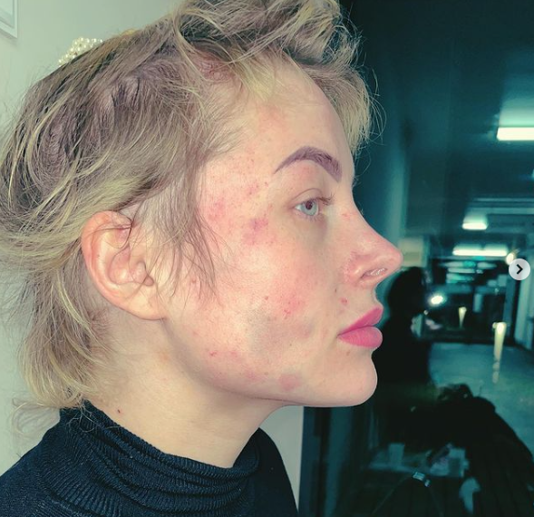 DSDS-Star brutal geschlagen!