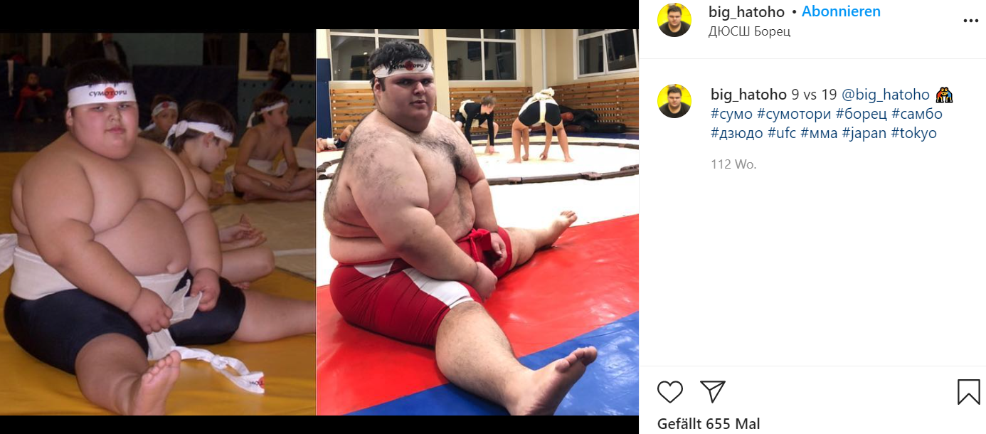 Das dickste Kind der Welt ist tot