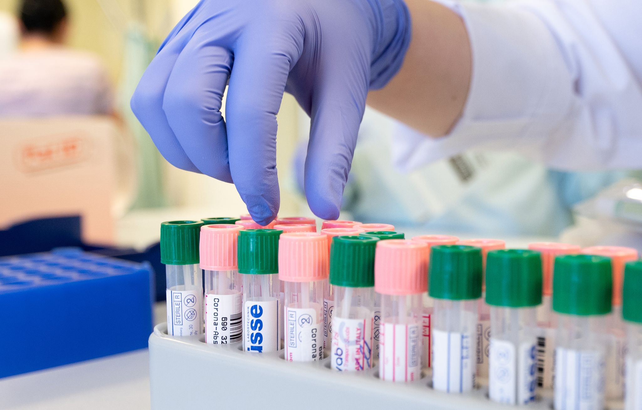 RKI registriert 84.655 Corona-Neuinfektionen