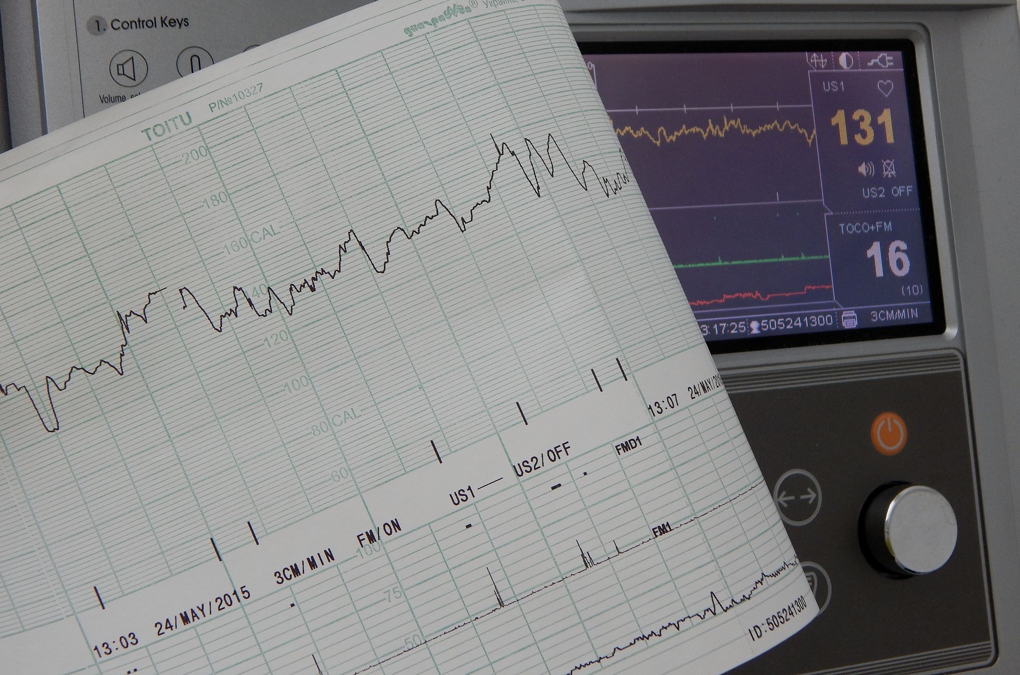 TV-Moderator gestorben – Herzversagen!