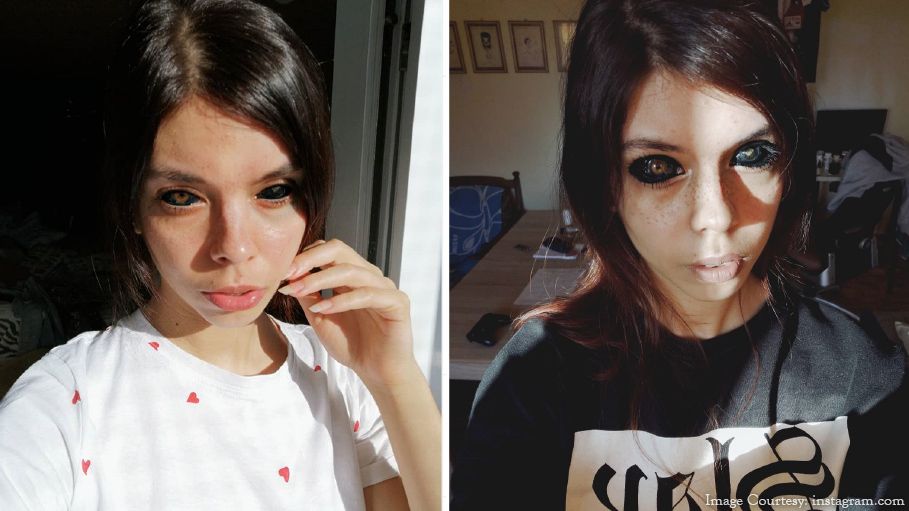 Tattoo-Horror: Frau(25) lässt sich die Augen tätowieren und erblindet!