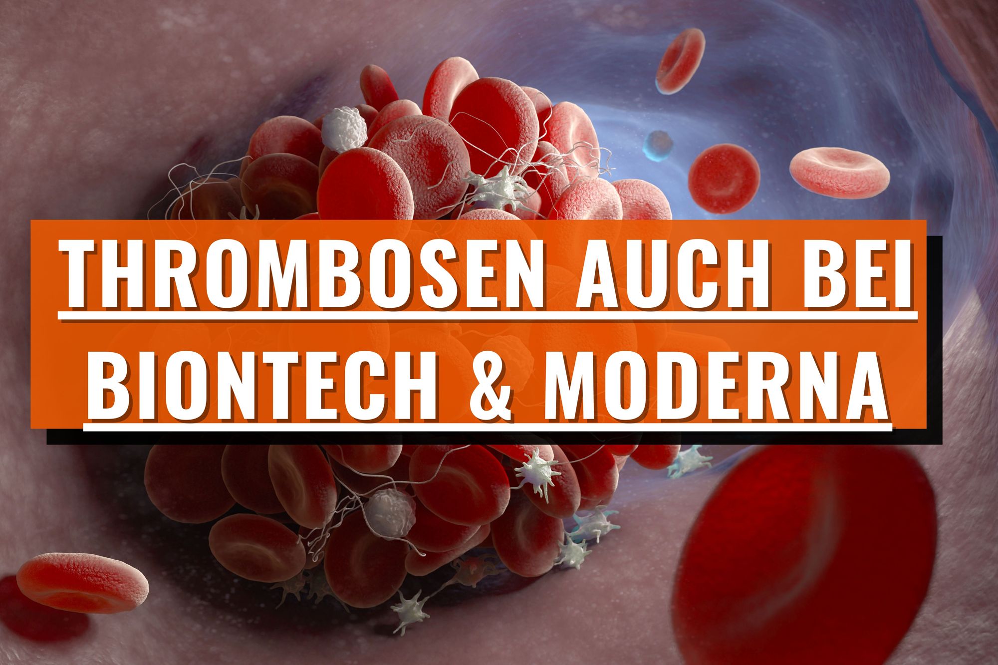 Thrombosen wohl auch bei Biontech-Pfizer und Moderna