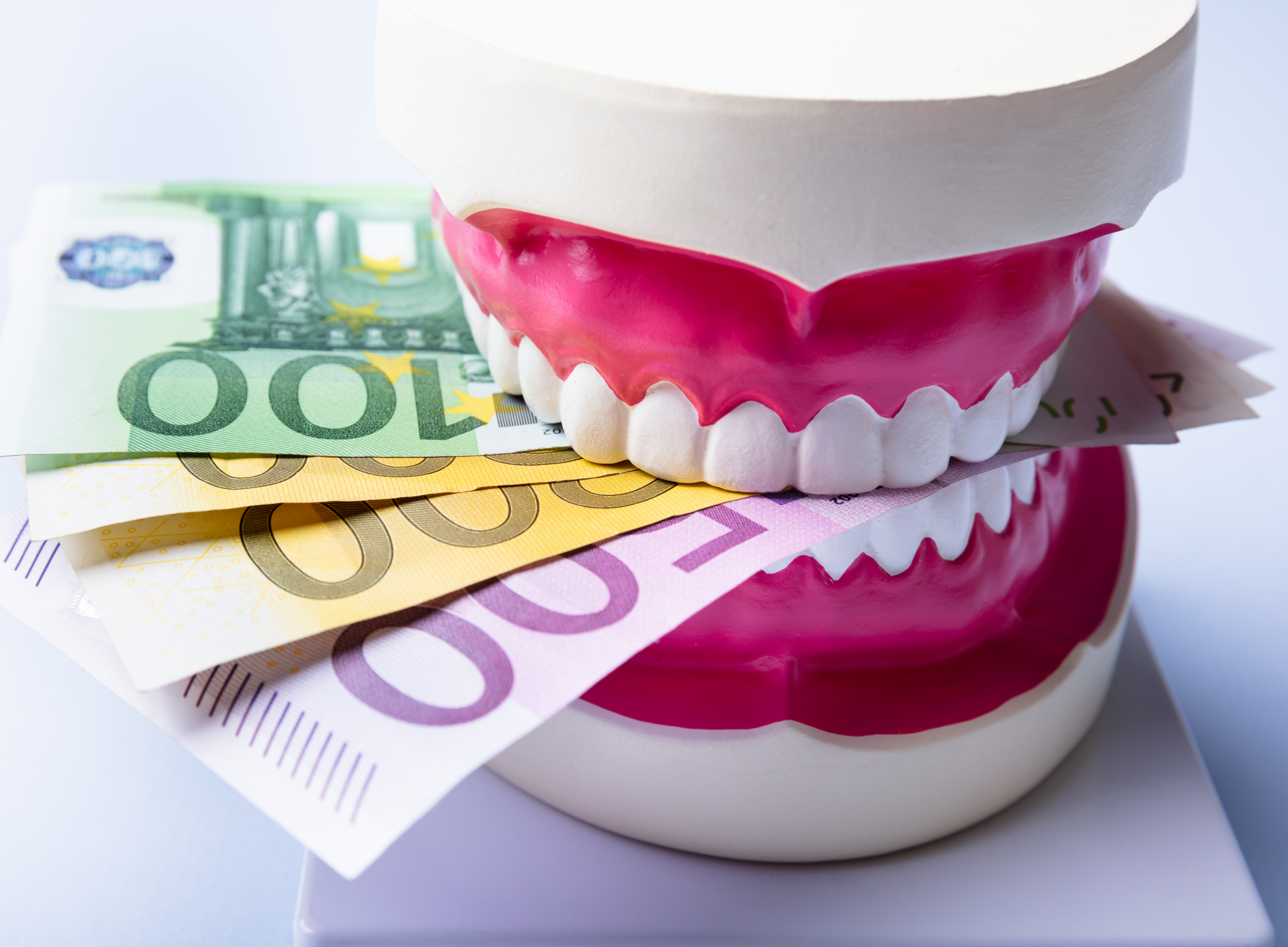 Zahnzusatzversicherung- Sinnvoll oder Geldmacherei?