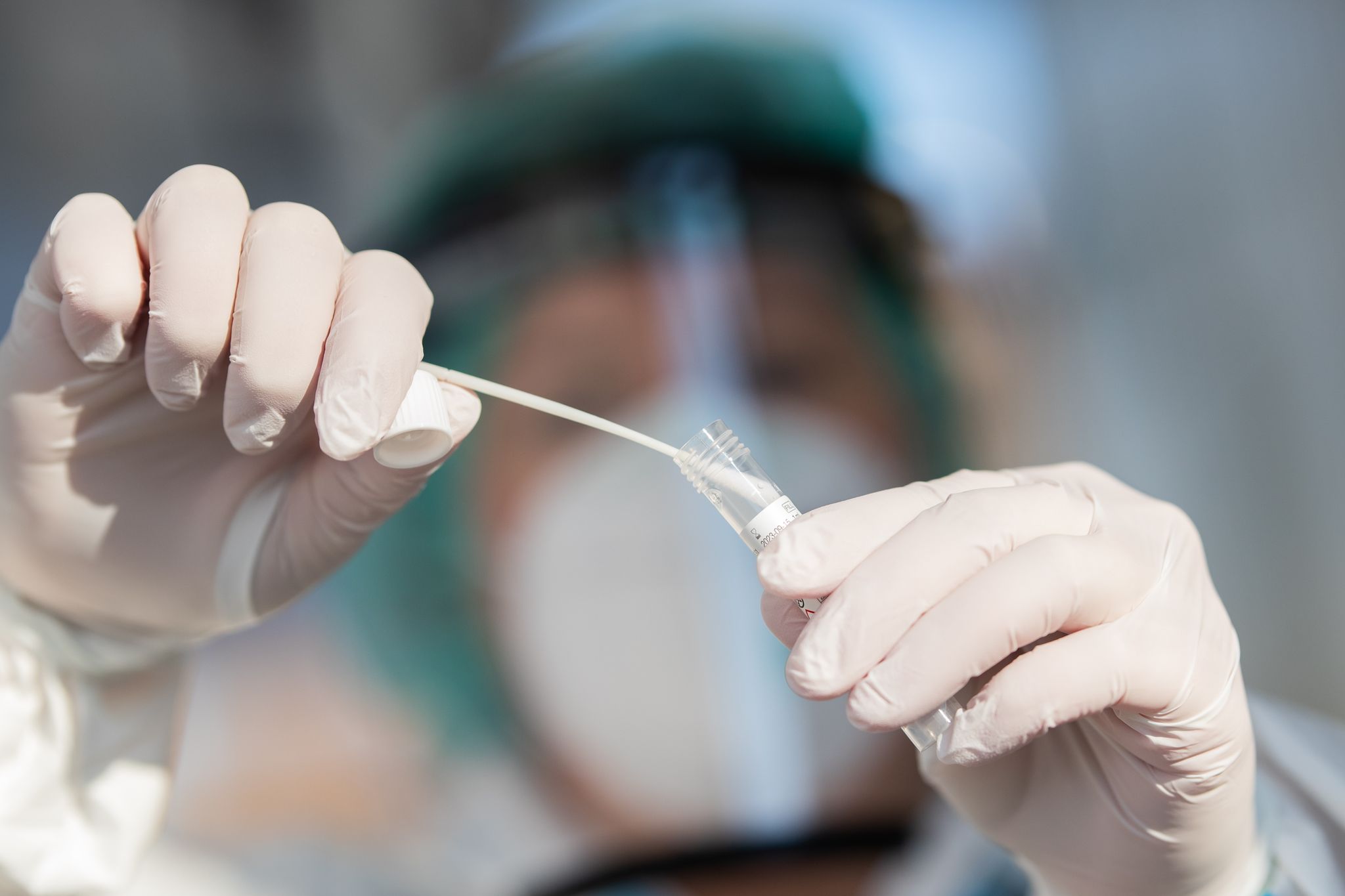 Sieben-Tage-Inzidenz steigt auf 720,4