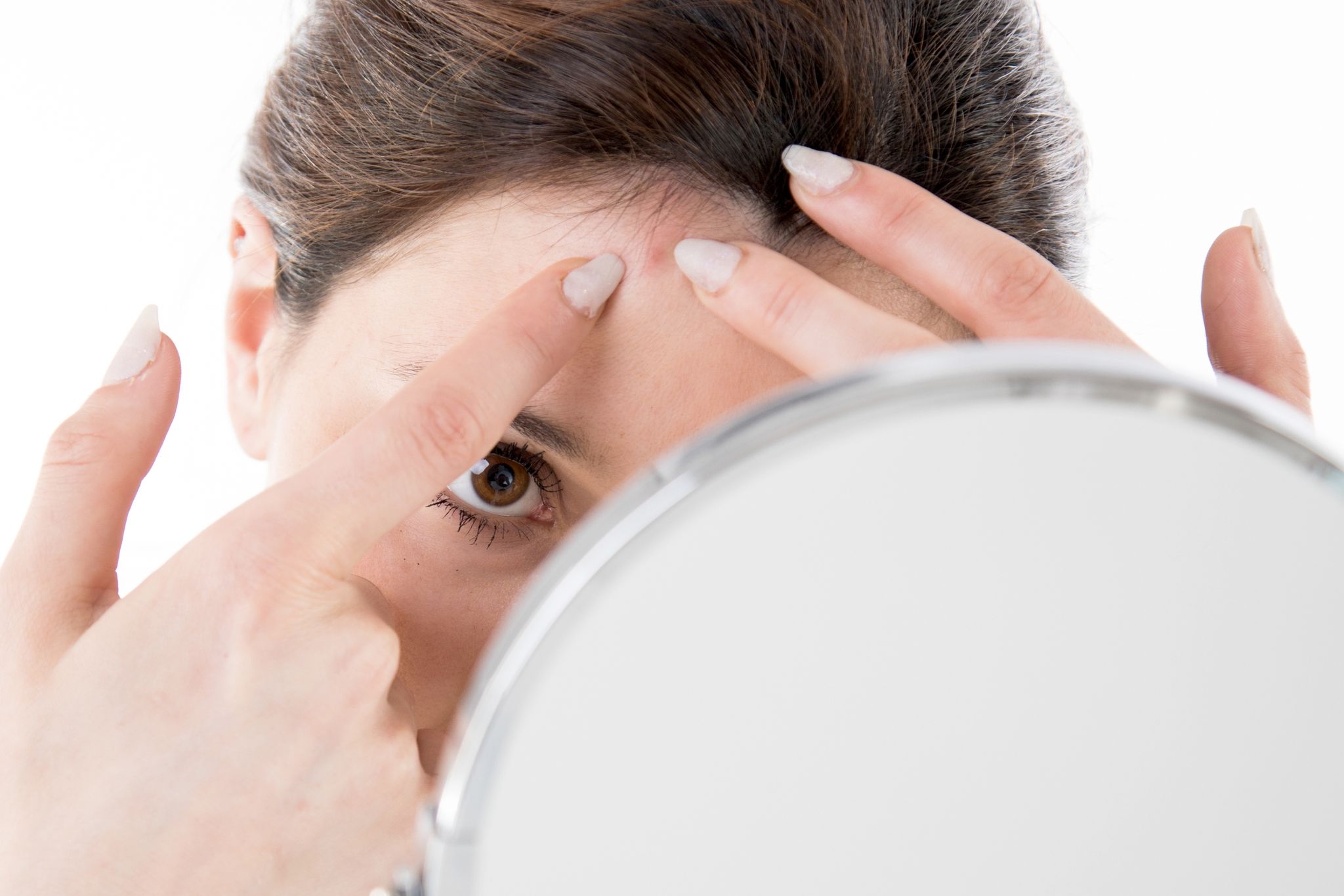 Wie die Ernährung Akne beeinflussen kann