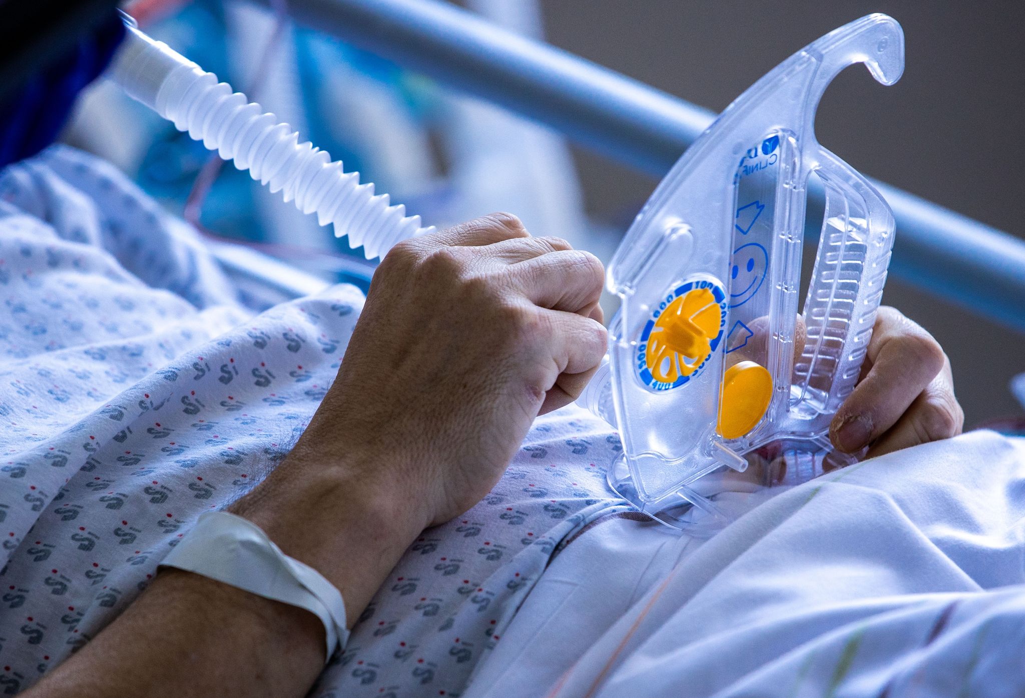 Leicht erhöhtes Risiko für neurologische Probleme nach Covid