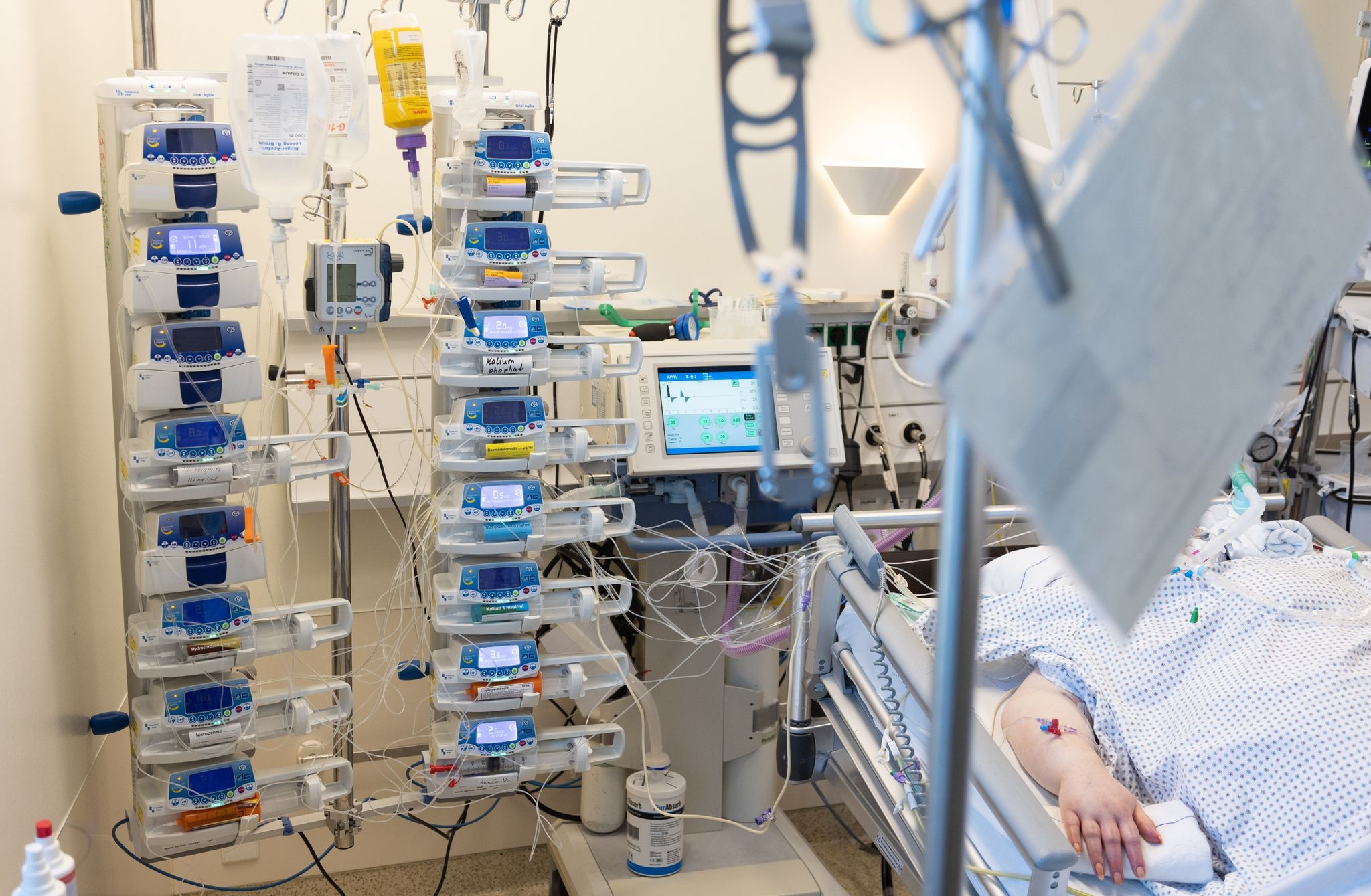 Genvariante verringert Corona-Sterberisiko deutlich