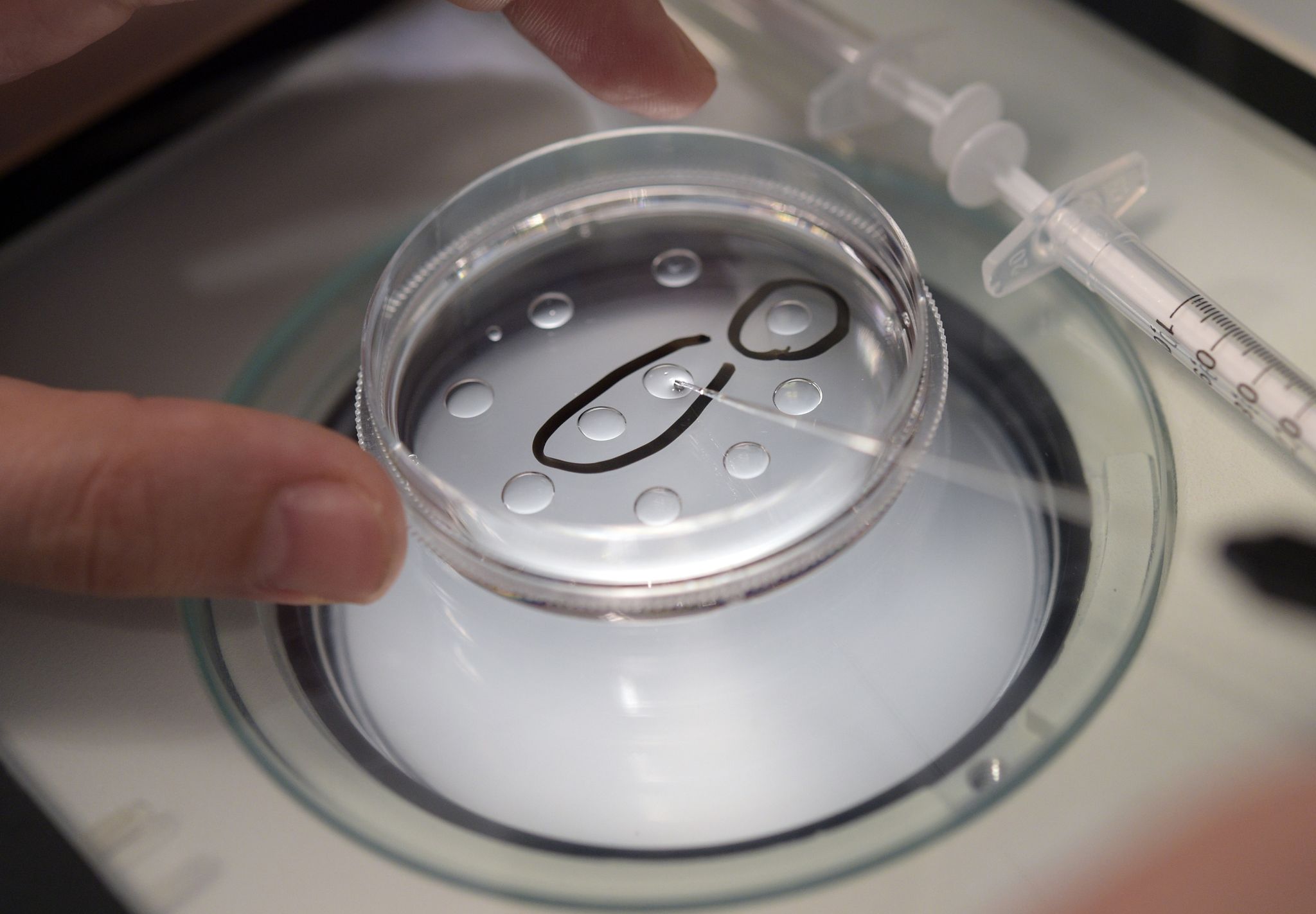 Später Kinderwunsch: Frauen länger fit – Eizellen aber nicht