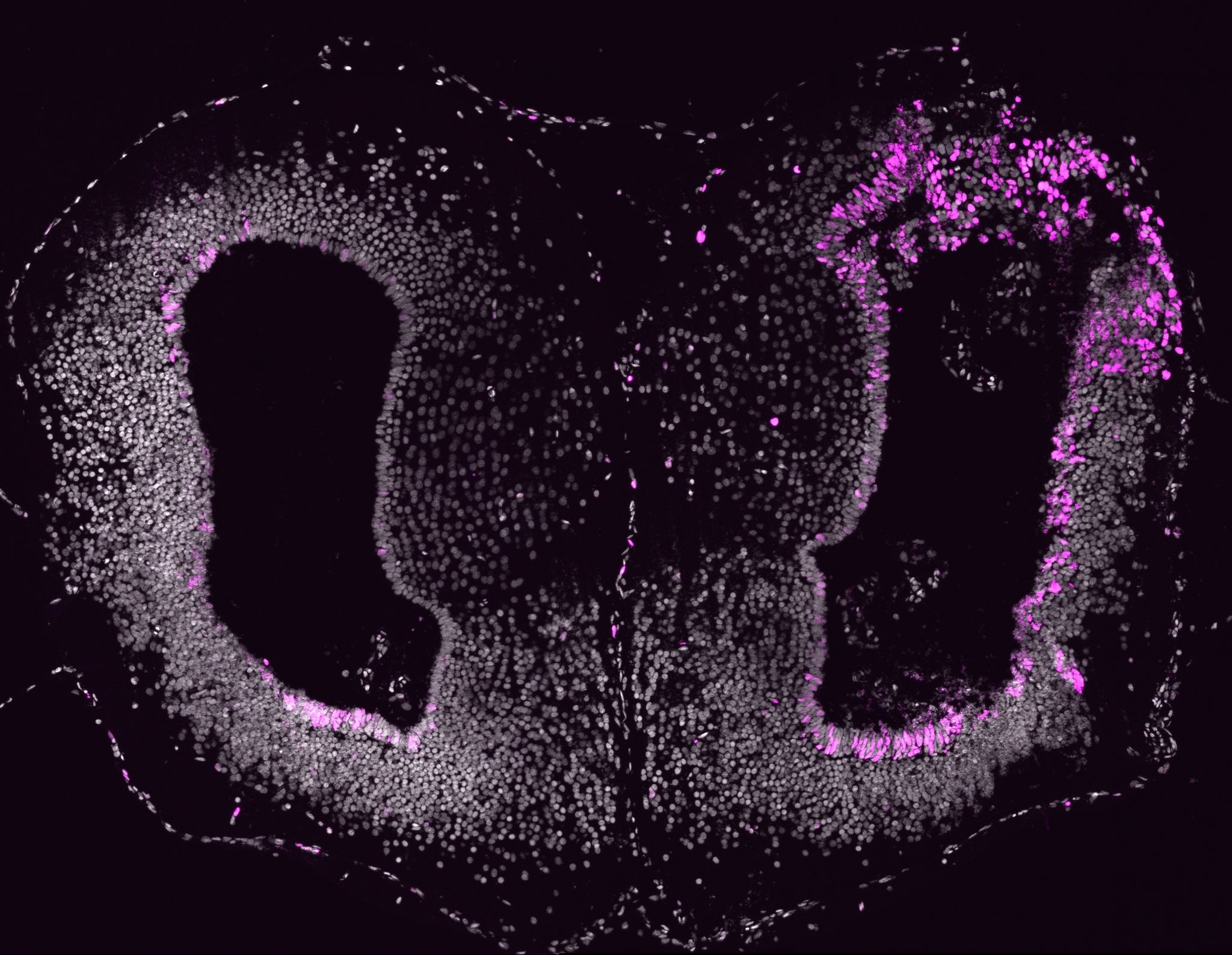 Axolotls können auch ihre Gehirne wiederherstellen