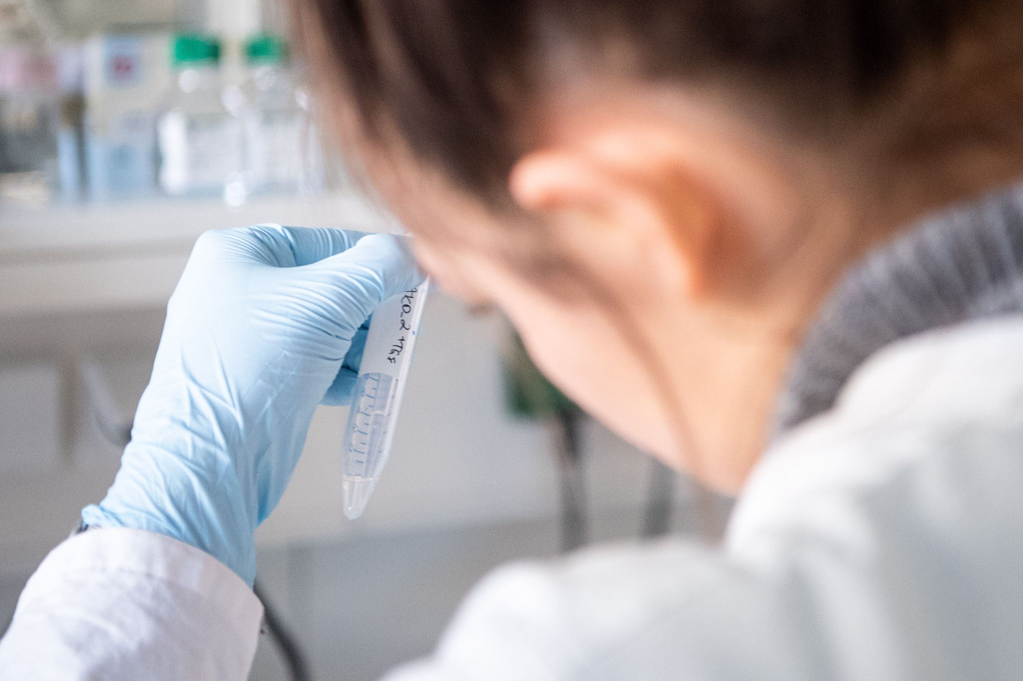 Deutschland bei Patenten von Frauen bei den Schlusslichtern