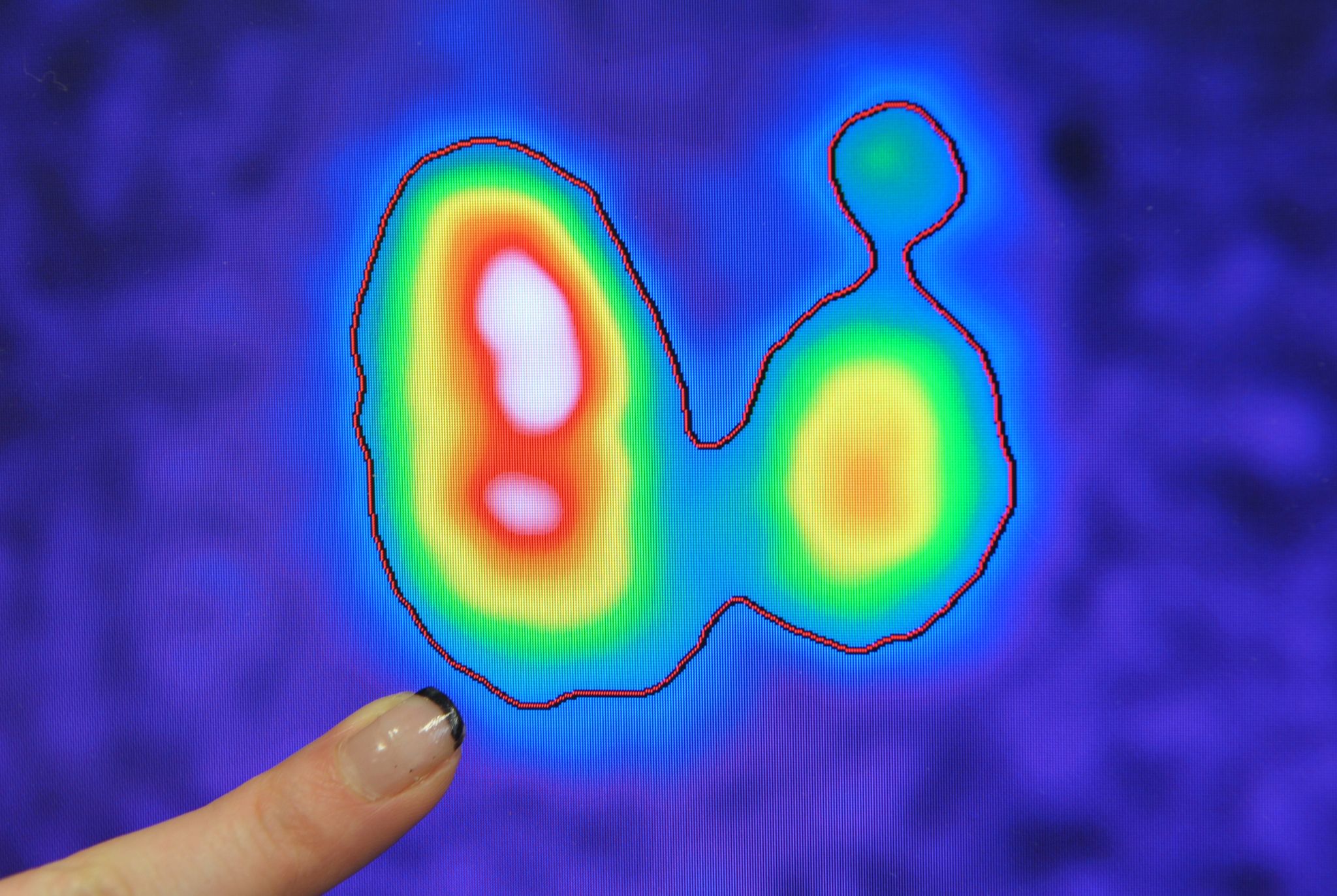 Wegen Reaktor-Problemen: Mediziner warnen vor Engpässen