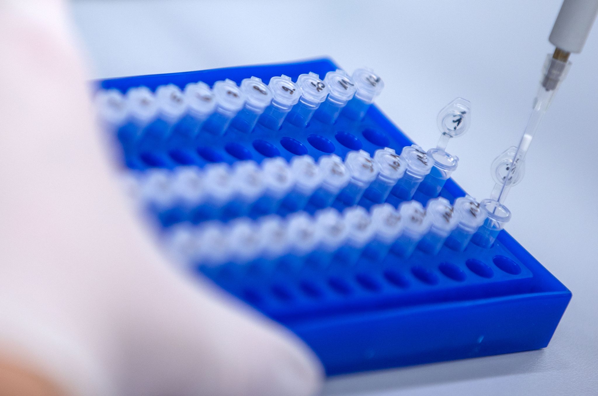 Zahl der Corona-Neuinfektionen sinkt – Inzidenz auch