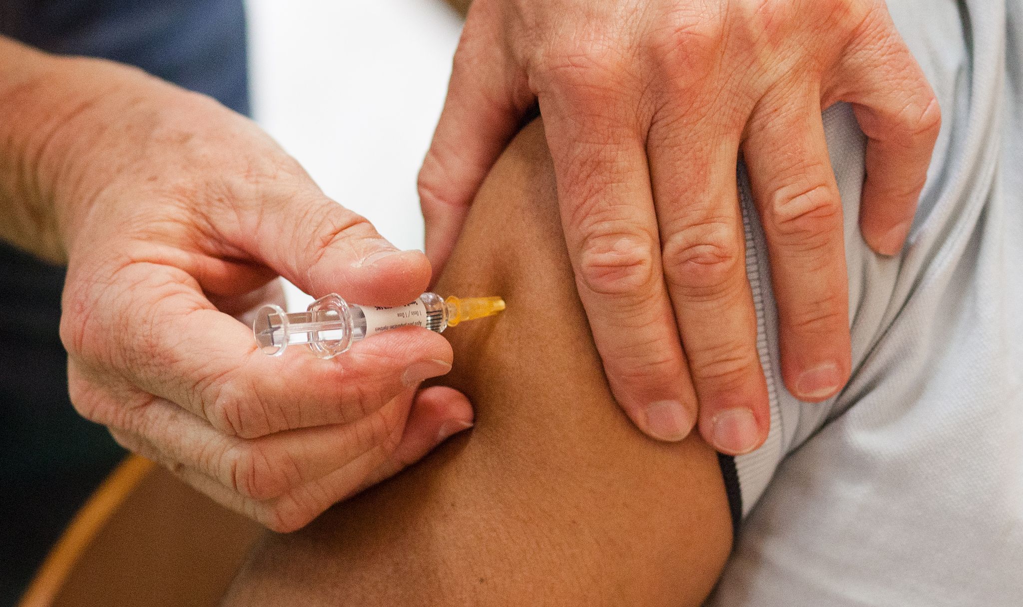 Steigende Fallzahlen von Hautdiphtherie in Europa