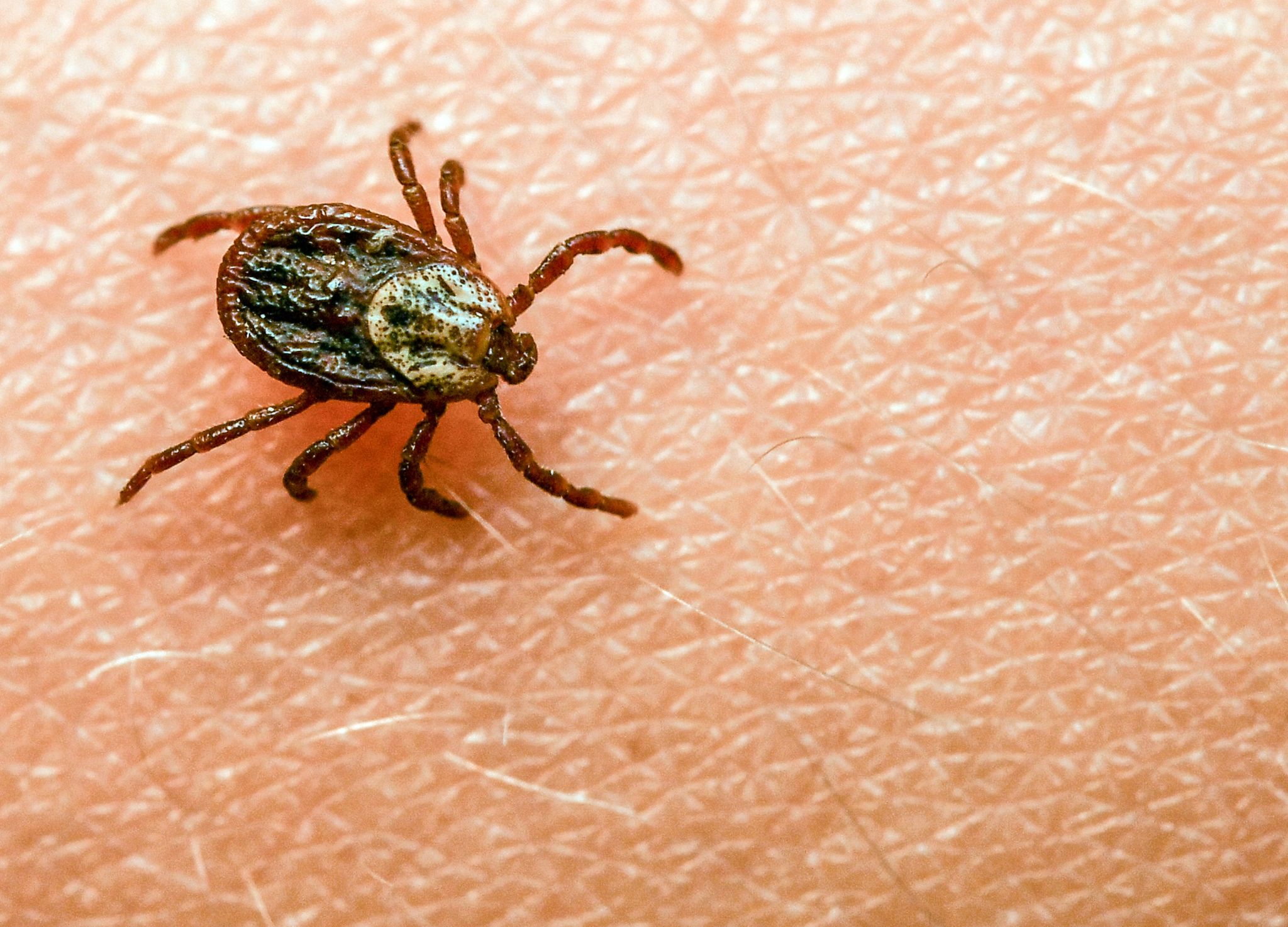 Faktencheck: Wie gefährlich sind Zeckenstiche wirklich?