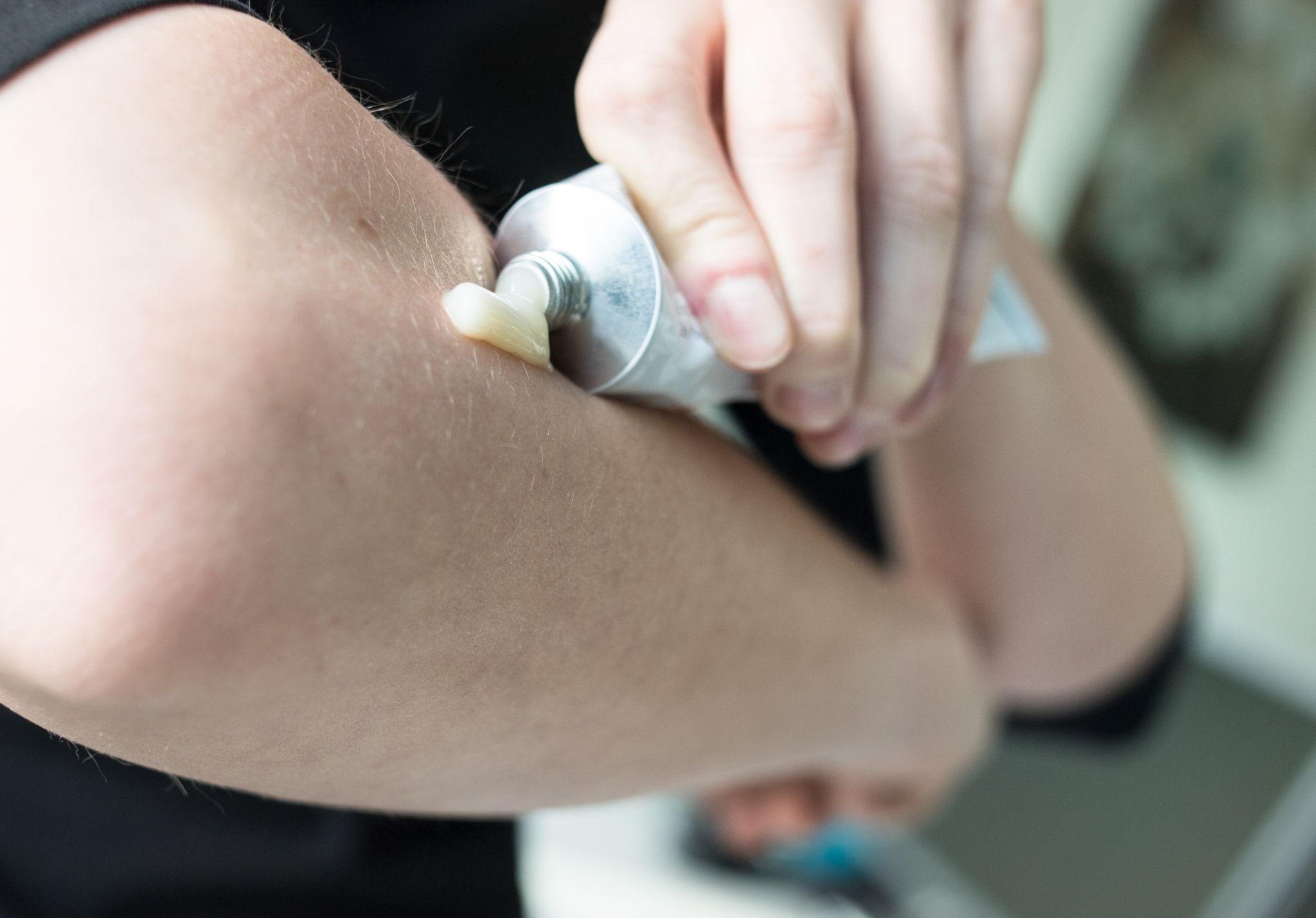 Rheuma-Studie: Niedrige Cortison-Dosen doch verträglicher