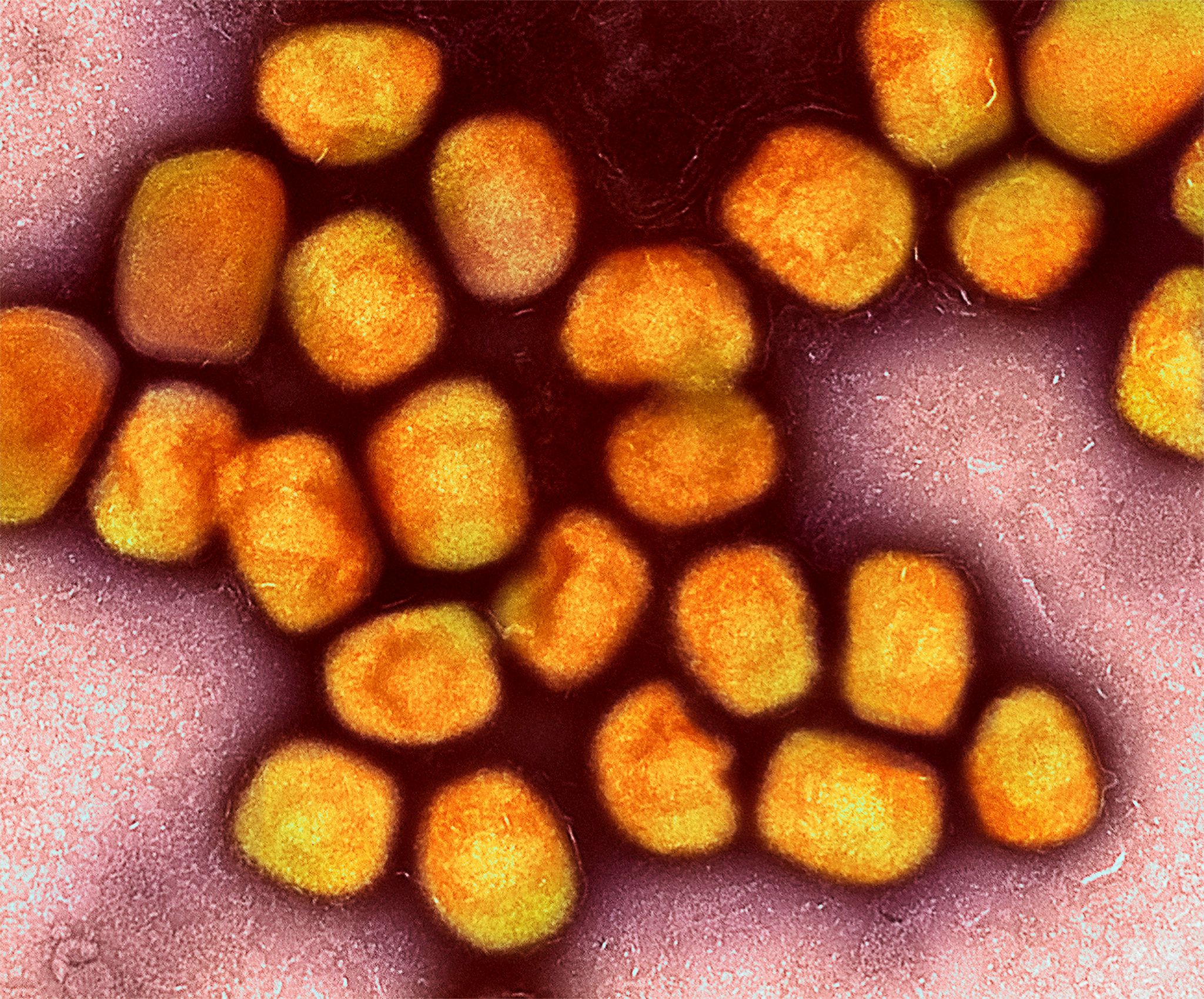 Das Virus ist noch da: Nach langer Ruhe wieder Mpox