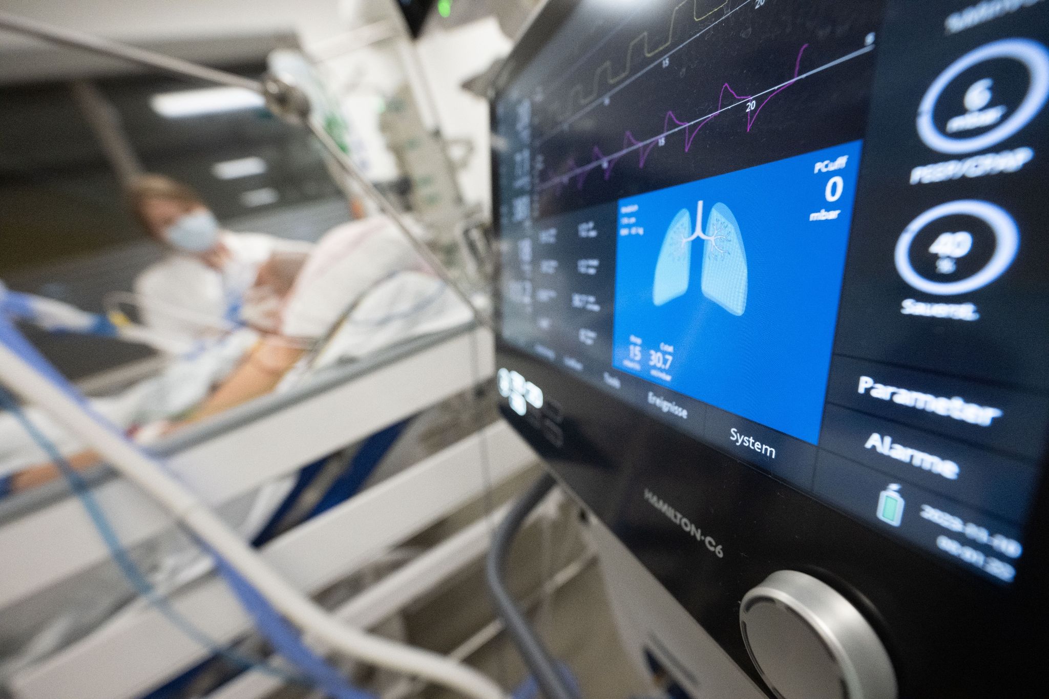 «Long Flu»: Langzeitfolgen auch nach Grippe möglich