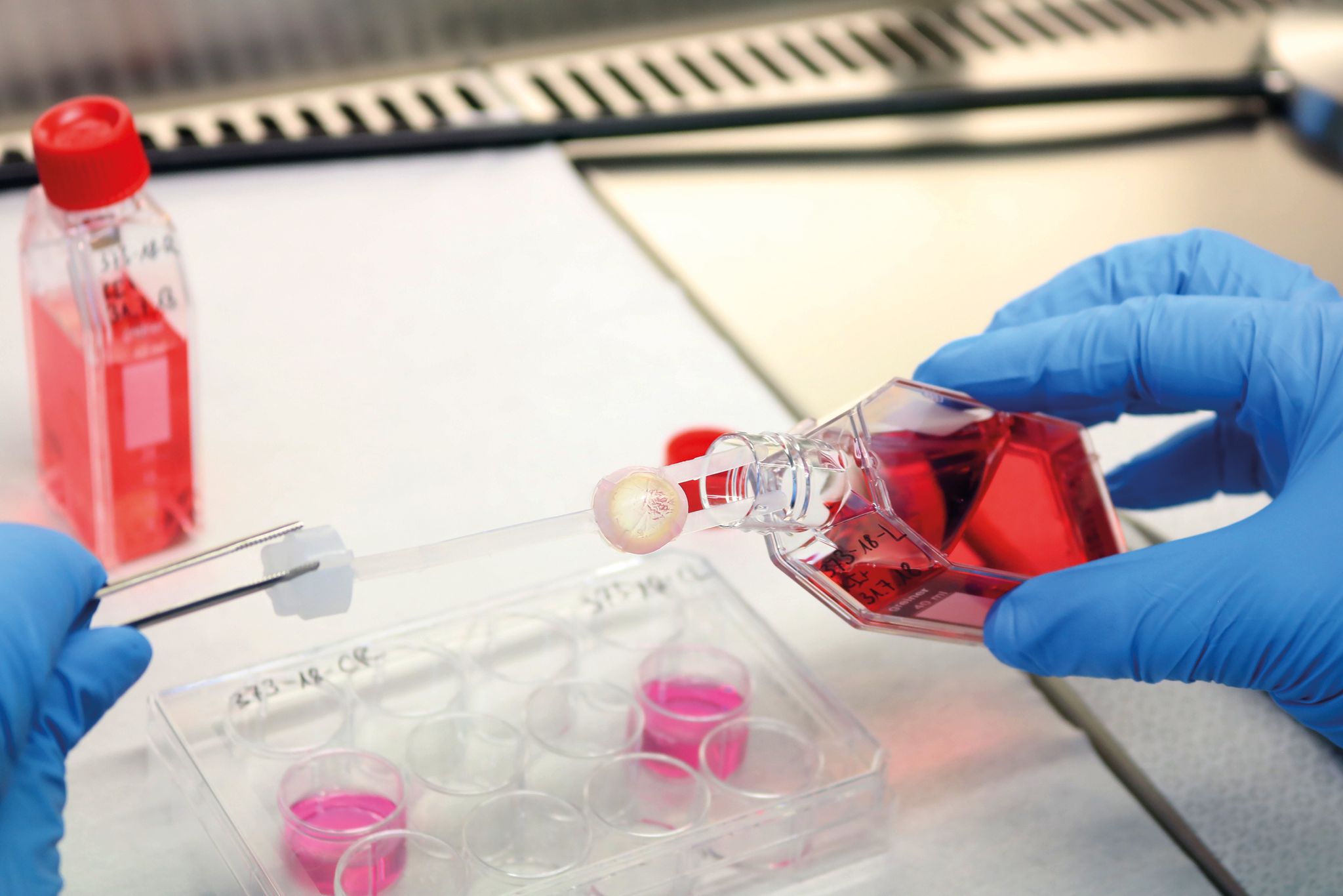 Mehr Gewebespenden – aber weiterhin Mangel an Herzklappen