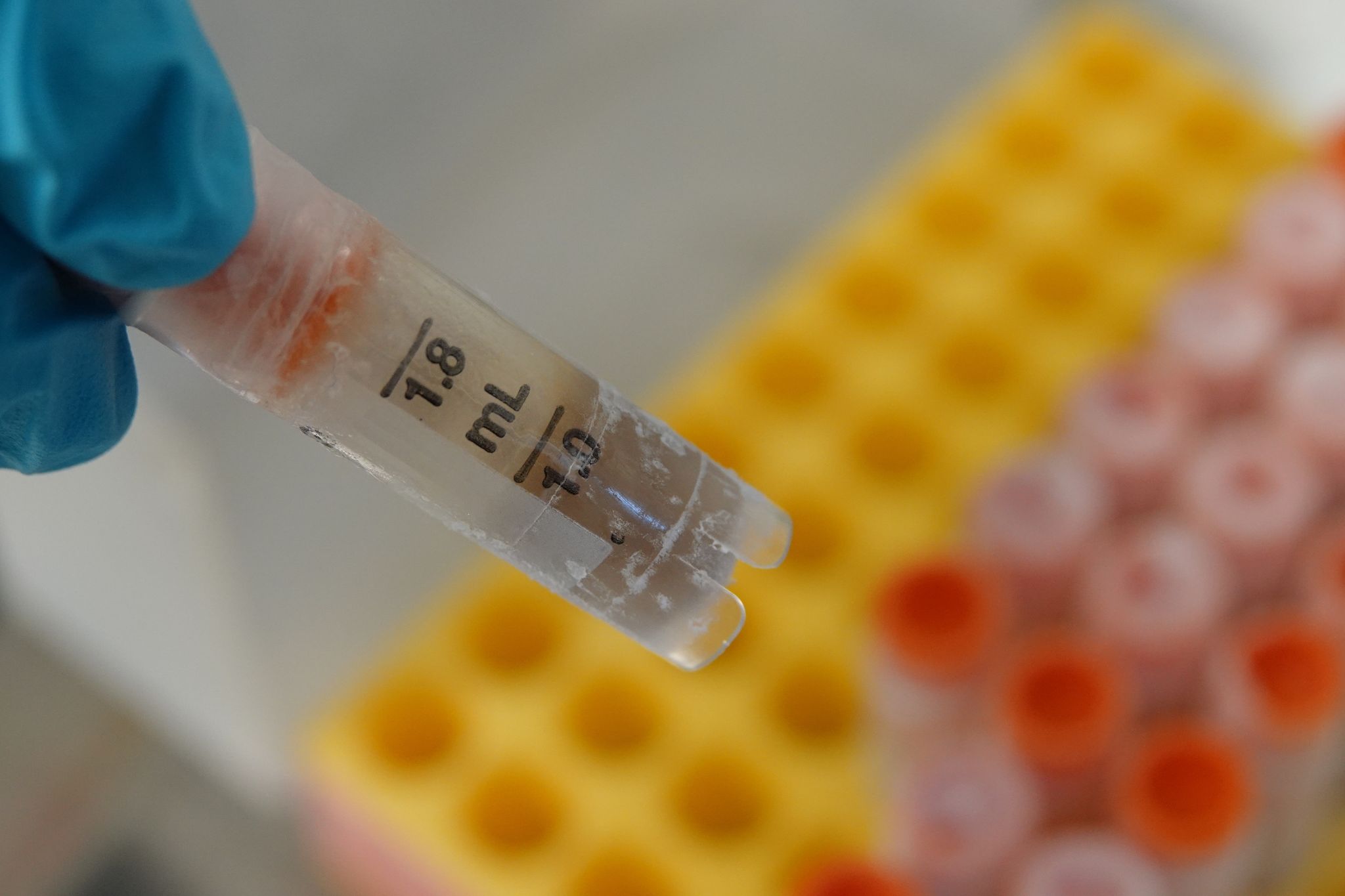 Ein Tresor für Kot: Projekt will Darmbakterien retten