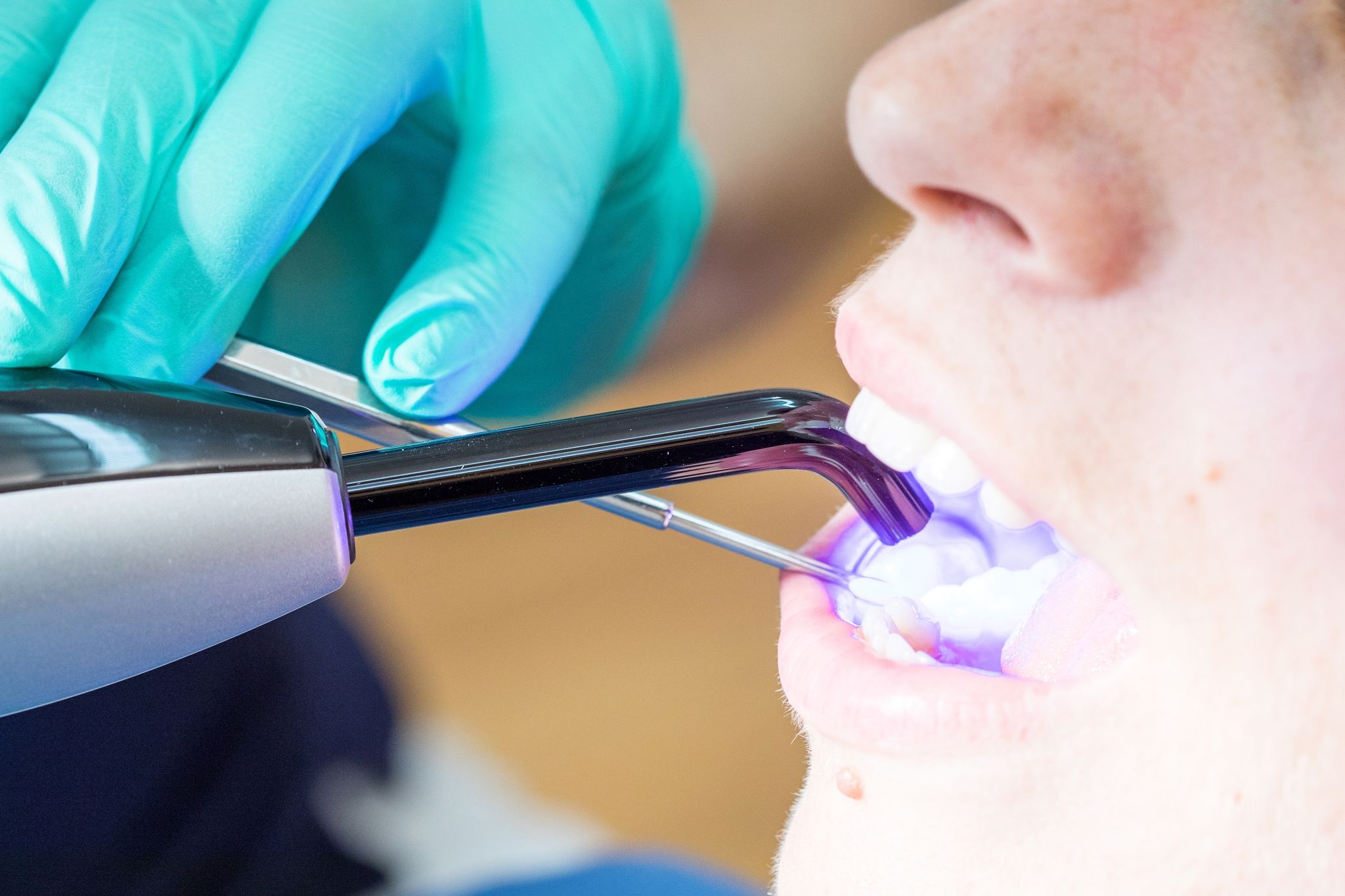 Kassen-Zahnärzte kritisieren Amalgam-Verbot durch EU