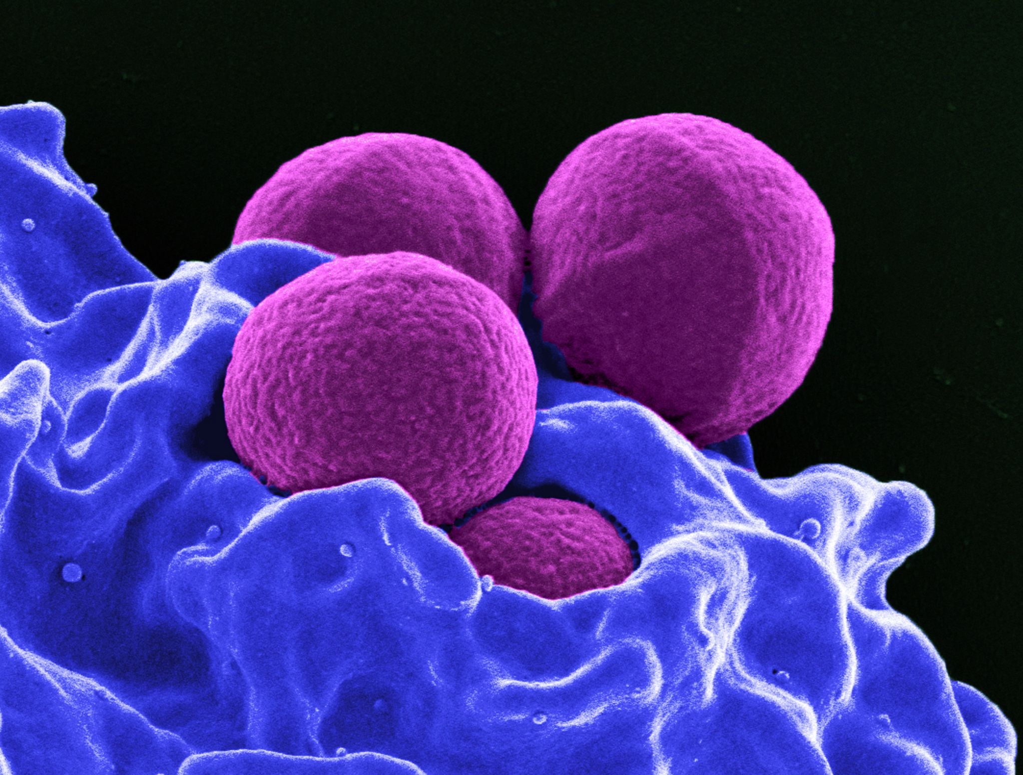 Alarmierende Prognose: Millionen Tote durch resistente Keime bis 2050