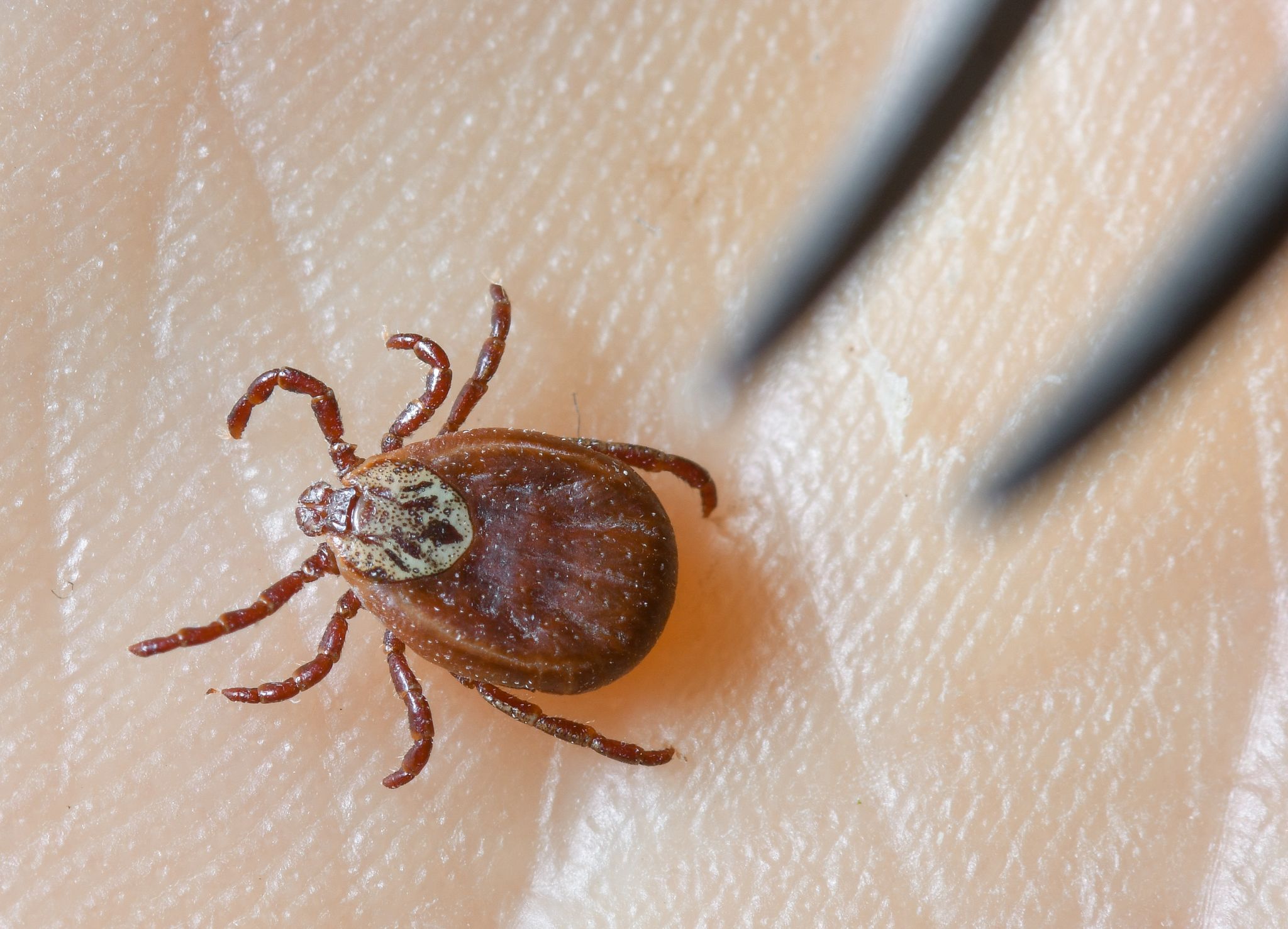 Tick season brings increase in FSME cases