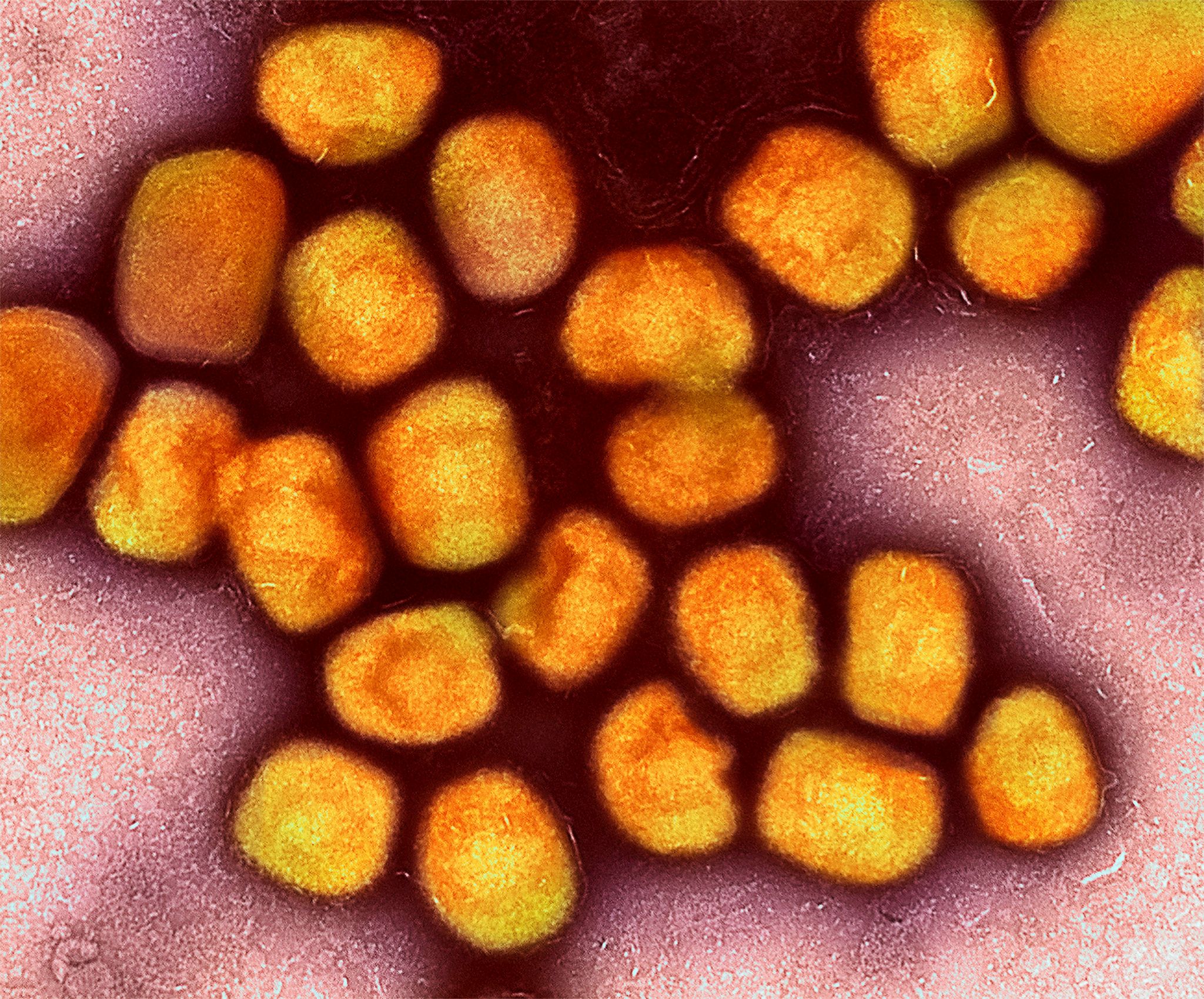 Weitere Fälle neuer Mpox-Variante in Deutschland