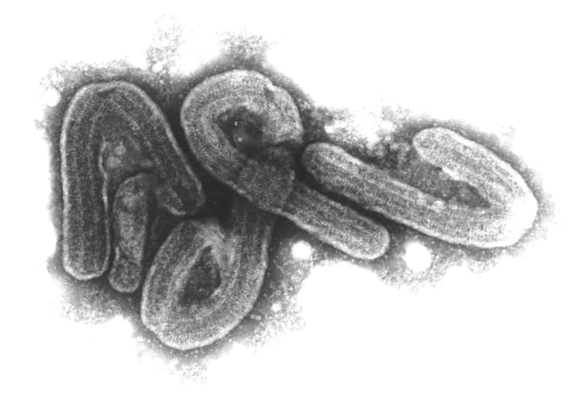 Tödliches Marburg-Virus in Tansania entdeckt