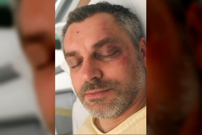 Verletzter Mann in Göttingen – Amtsgericht ordnet Veröffentlichung von Foto an