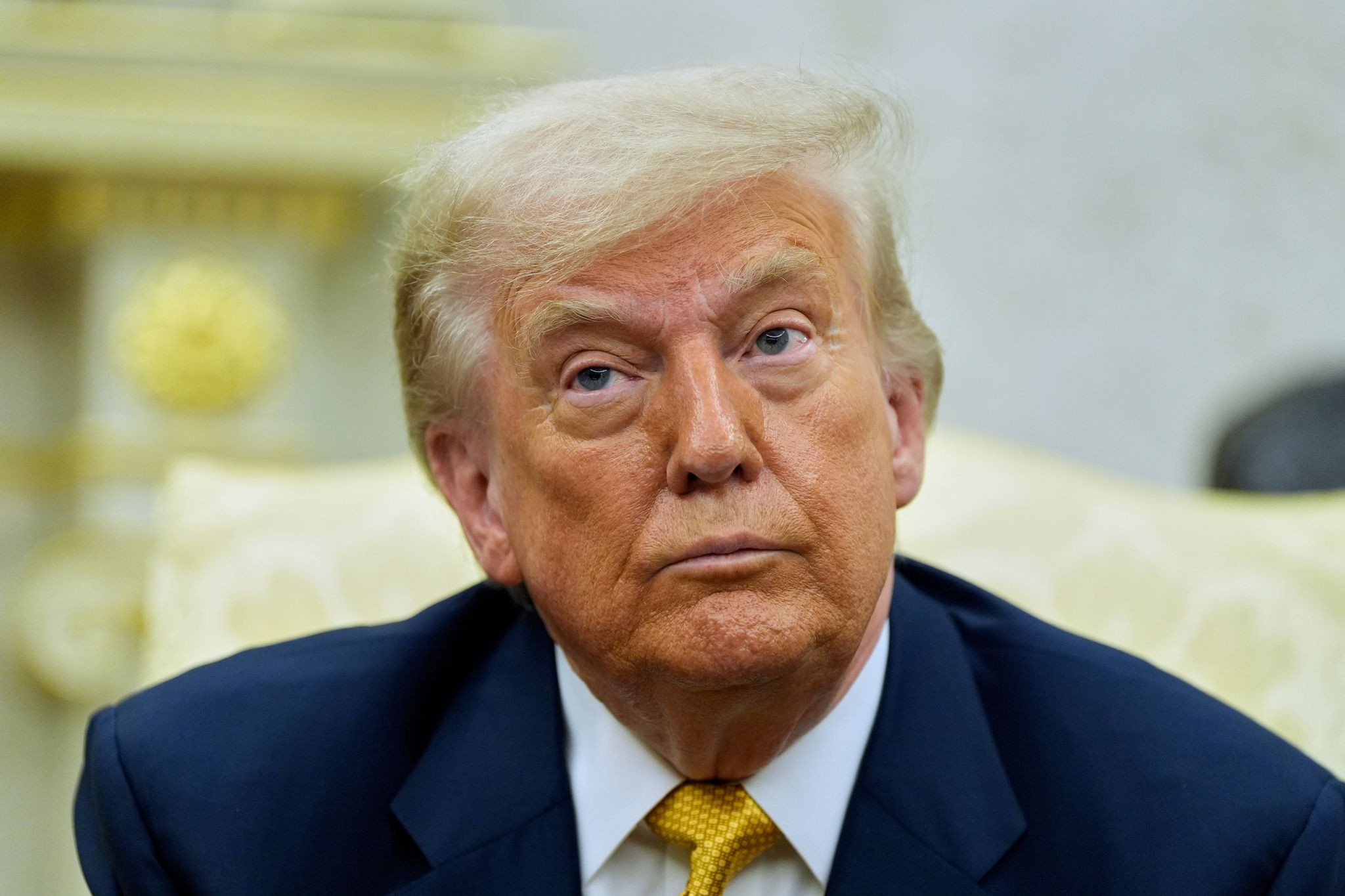 Weißes Haus: Trump hat chronisch venöse Insuffizienz