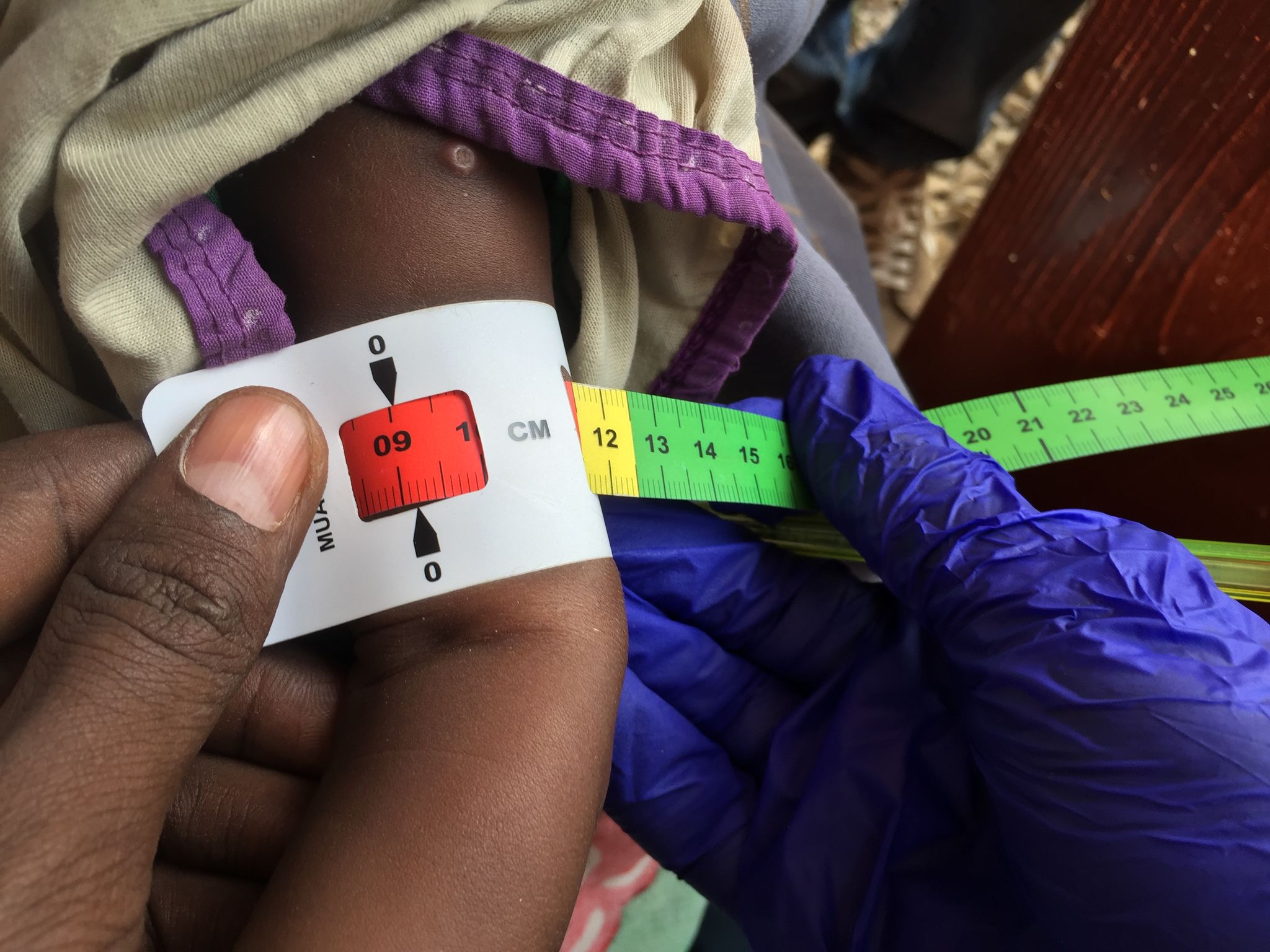 UNICEF warnt: Kinder in belagerter sudanesischer Stadt El Fascher in Lebensgefahr