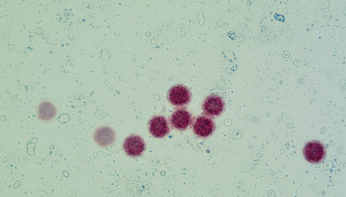 Darmparasit Cyclospora breitet sich in den USA aus