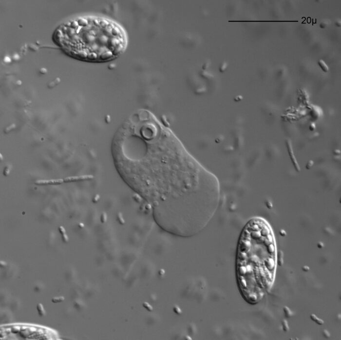 Der Tag: Achtjährige stirbt nach Infektion mit
